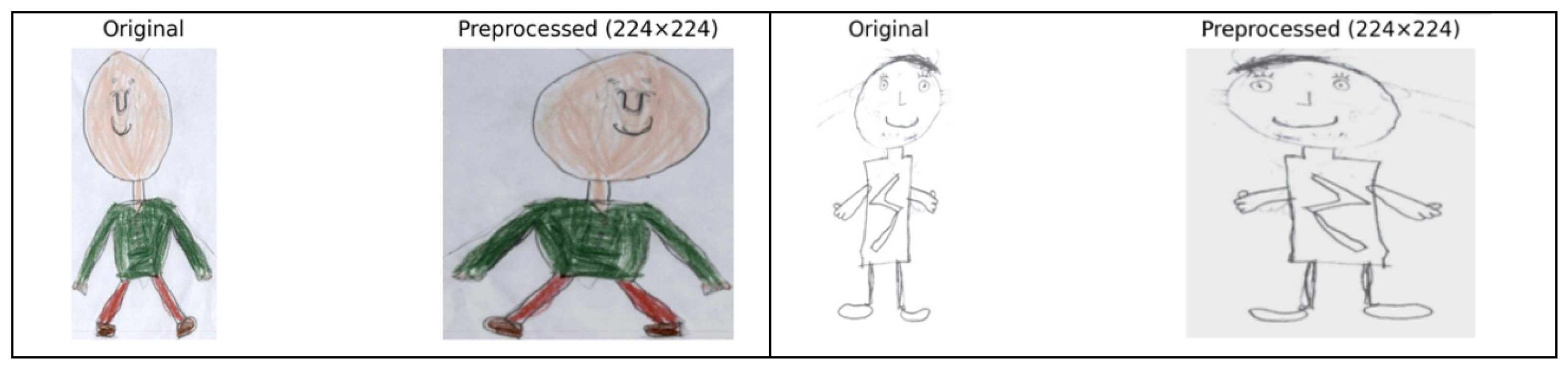 Automated Anatomical Feature Analysis and Scoring for Draw-a-Person ...