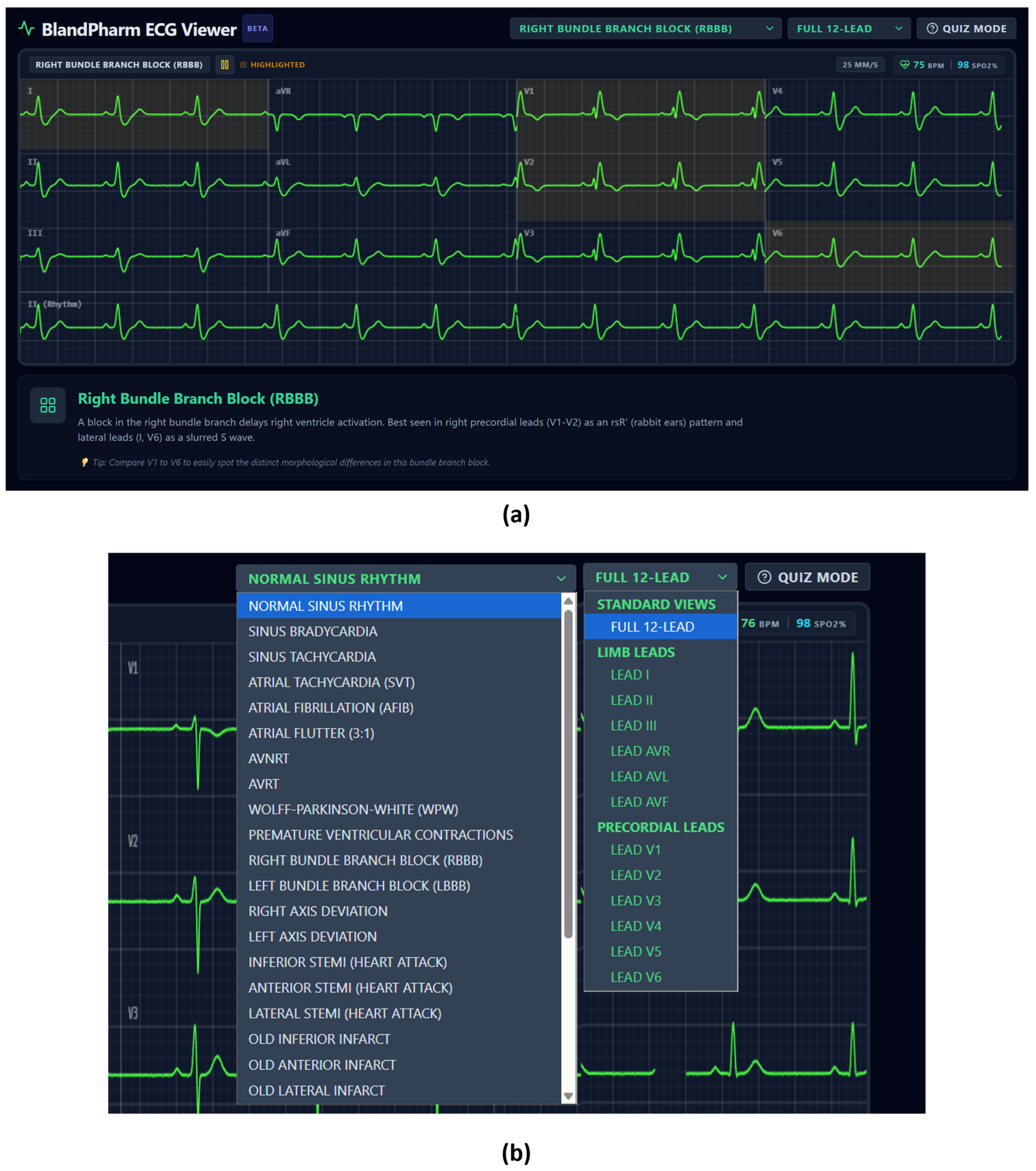 Mindware Training Module Ecg Harnessing “Vibe Coding” to Rapidly Develop Tailored Educational Apps ...