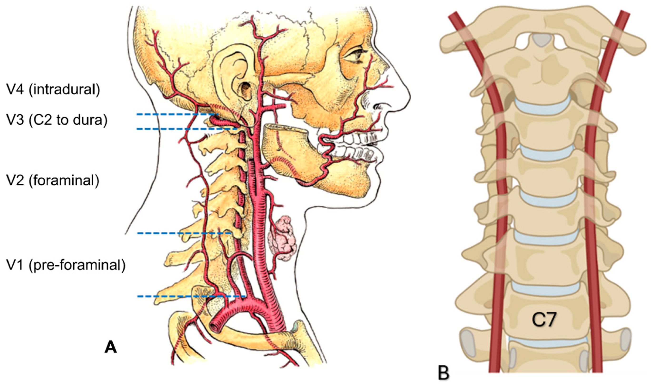 Morphological Characteristics of Transverse Foramina of Seventh ...