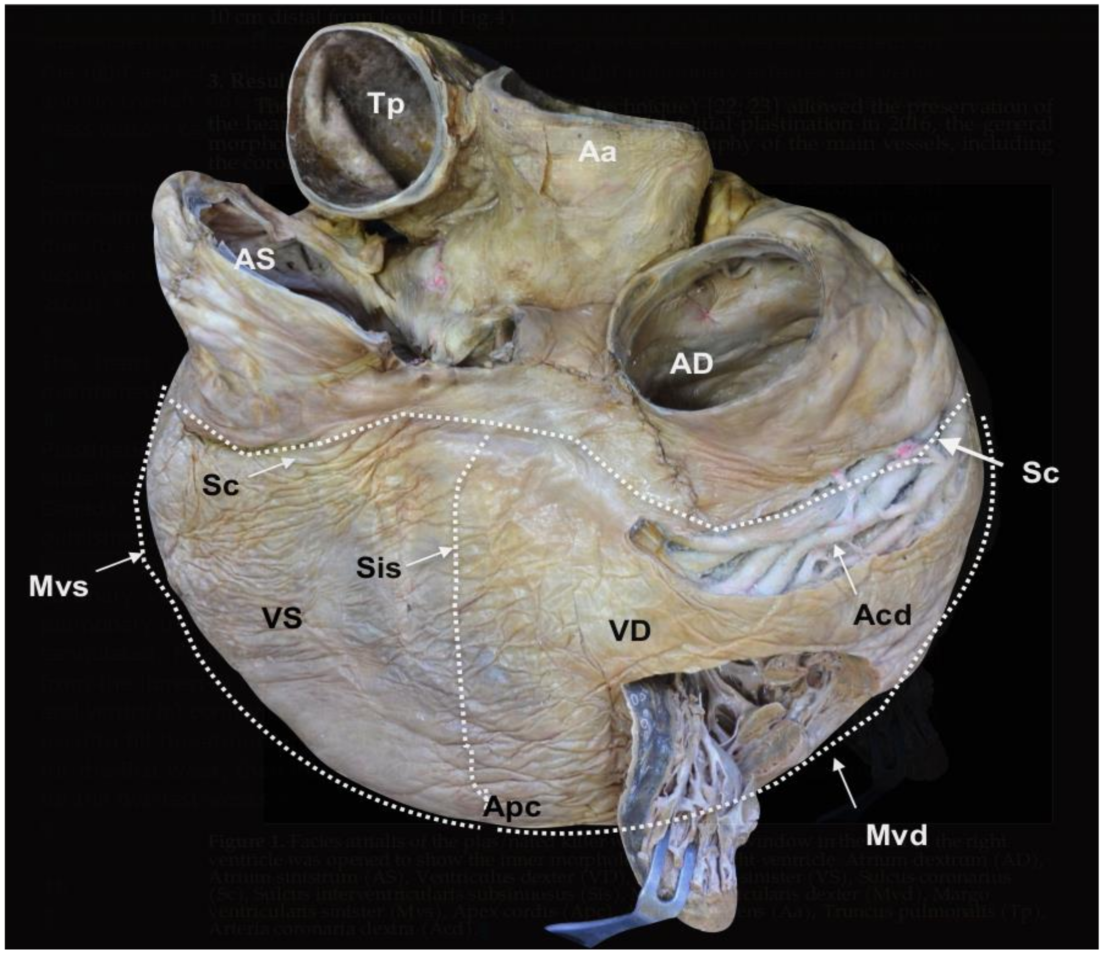 Animals | Free Full-Text | The Heart of the Killer Whale: Description of a  Plastinated Specimen and Review of the Available Literature