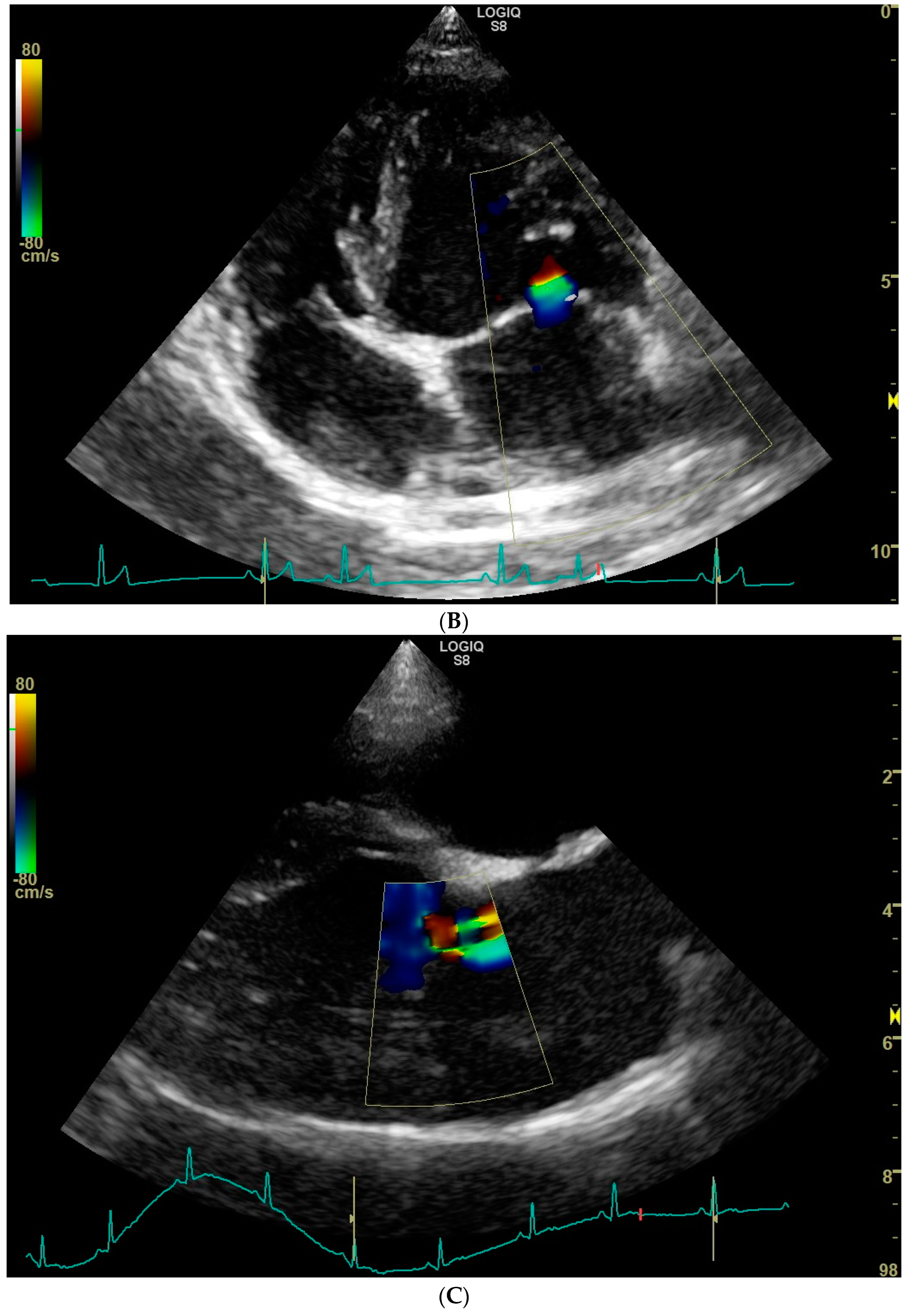 Animals | Free Full-Text | Prevalence of Echocardiographic Evidence of  Trace Mitral and Aortic Valve Regurgitation in 50 Clinically Healthy, Young  Adult Labrador Retrievers without Heart Murmur
