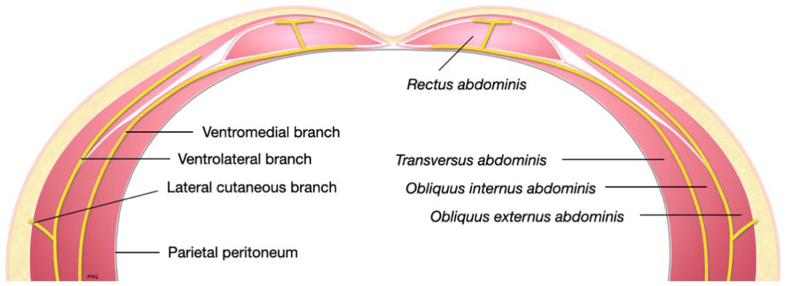 obliquus internus abdominis