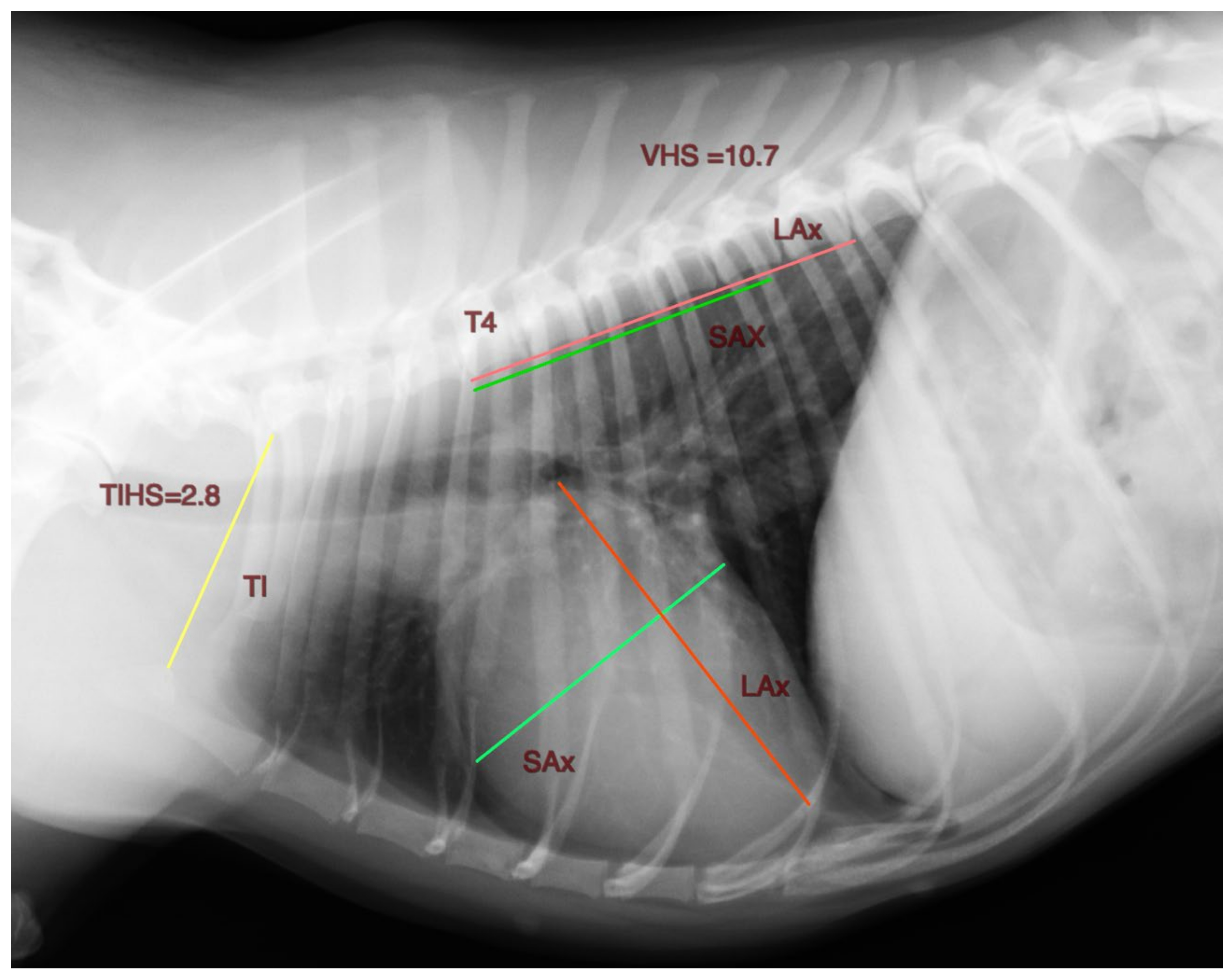 Ribcage of 4 day old patient. Measurements of the width of the chest