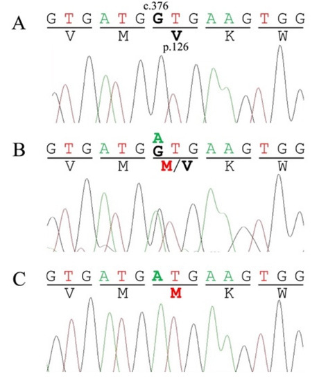 A new regulatory mechanism of STARD1 in Niemann-Pick disease type C (NPC),  discovered