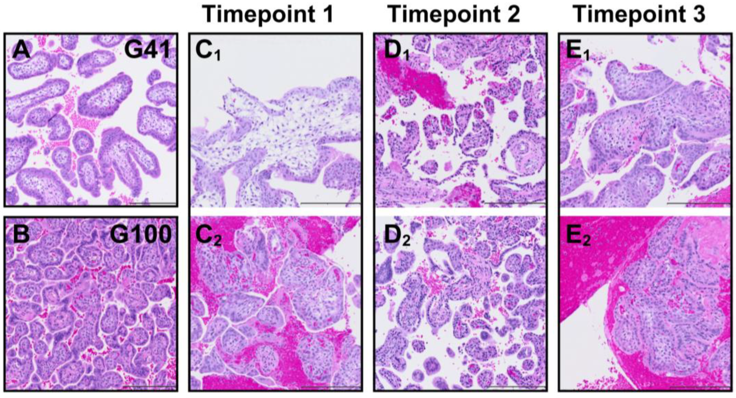 Application of Chorionic Villus Sampling to Longitudinal Studies in ...