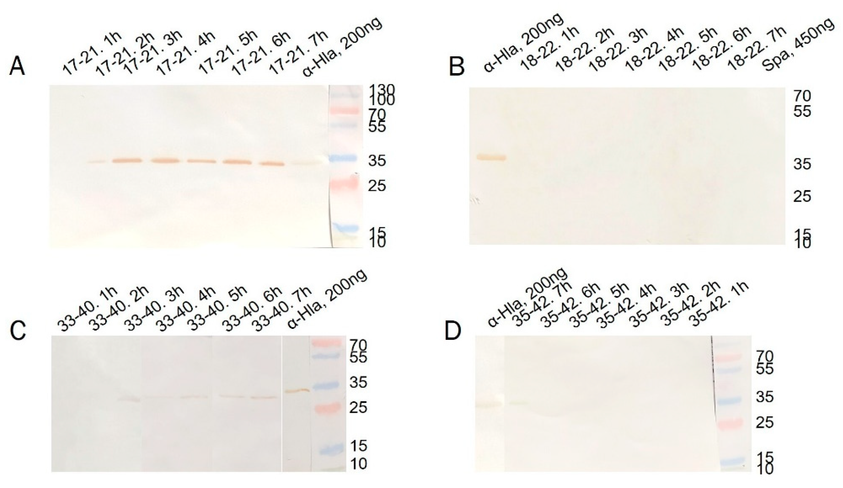 Genetic and Phenotypic Characteristics of Five Staphylococcus aureus ...