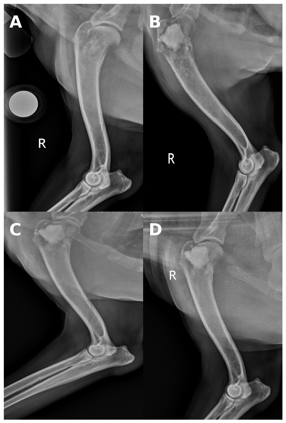 Percutaneous Cementoplasty as a Monotherapy in the Treatment of ...