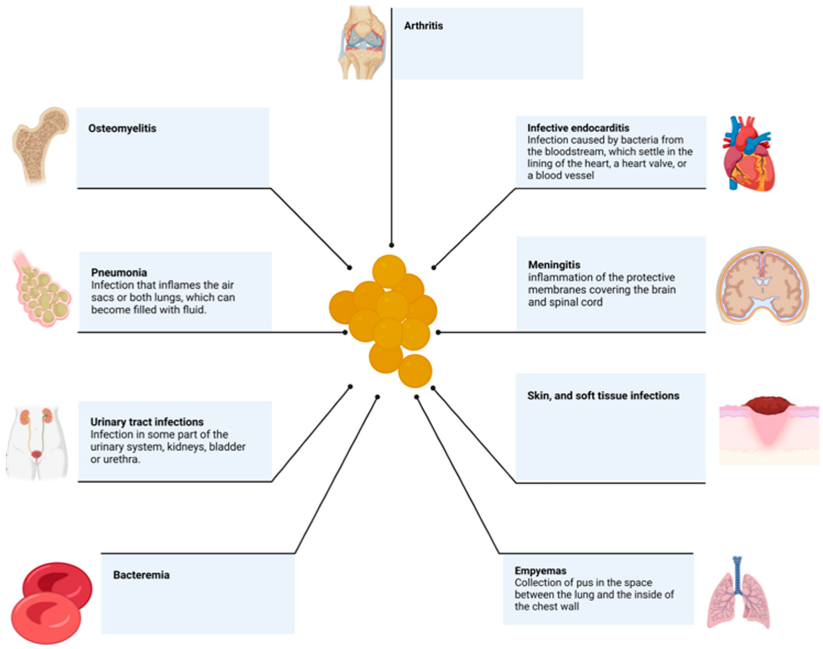 Trial of existing antibiotic for treating Staphylococcus aureus bacteremia  begins