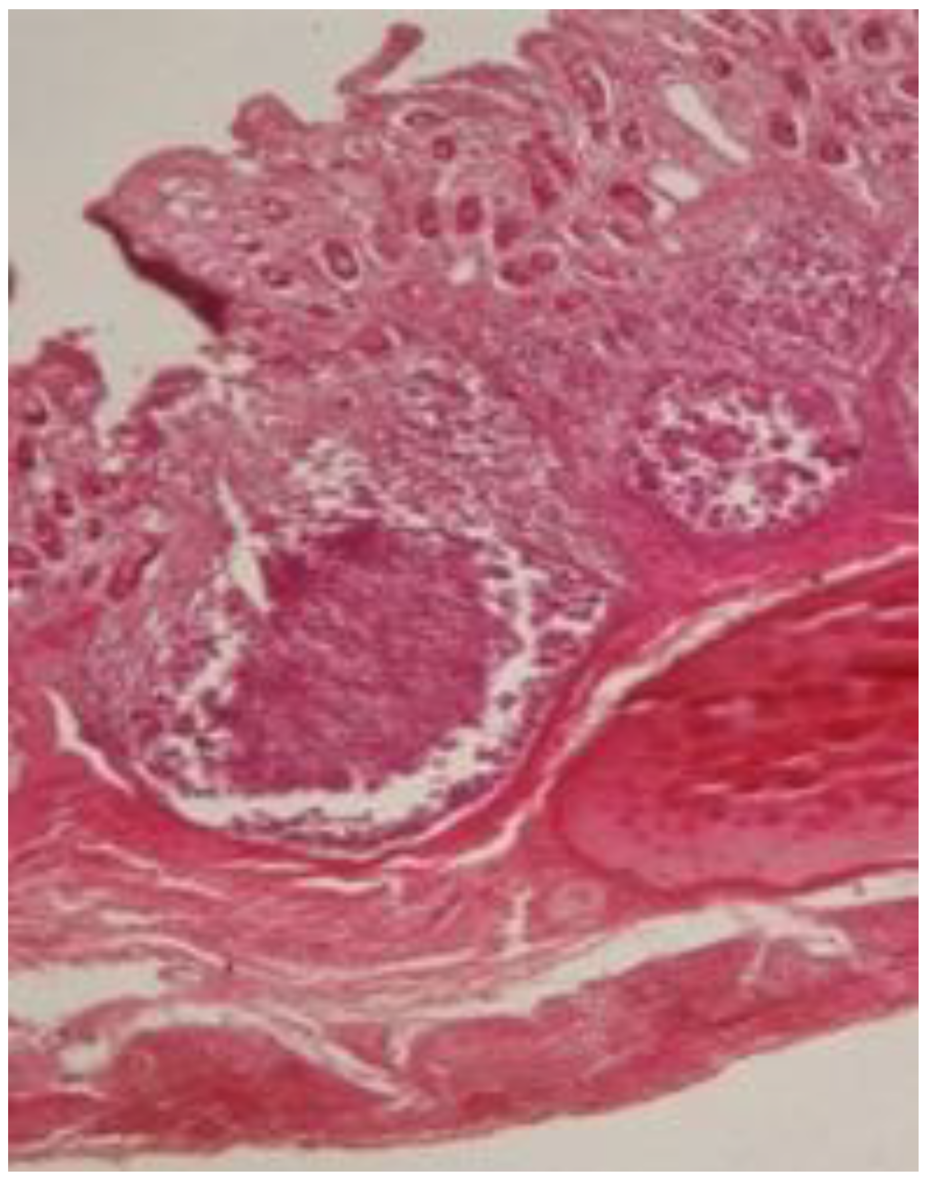 C. Diff In Rabbits Fatal Systemic Infection Caused by Multidrug-Resistant Clostridioides ...