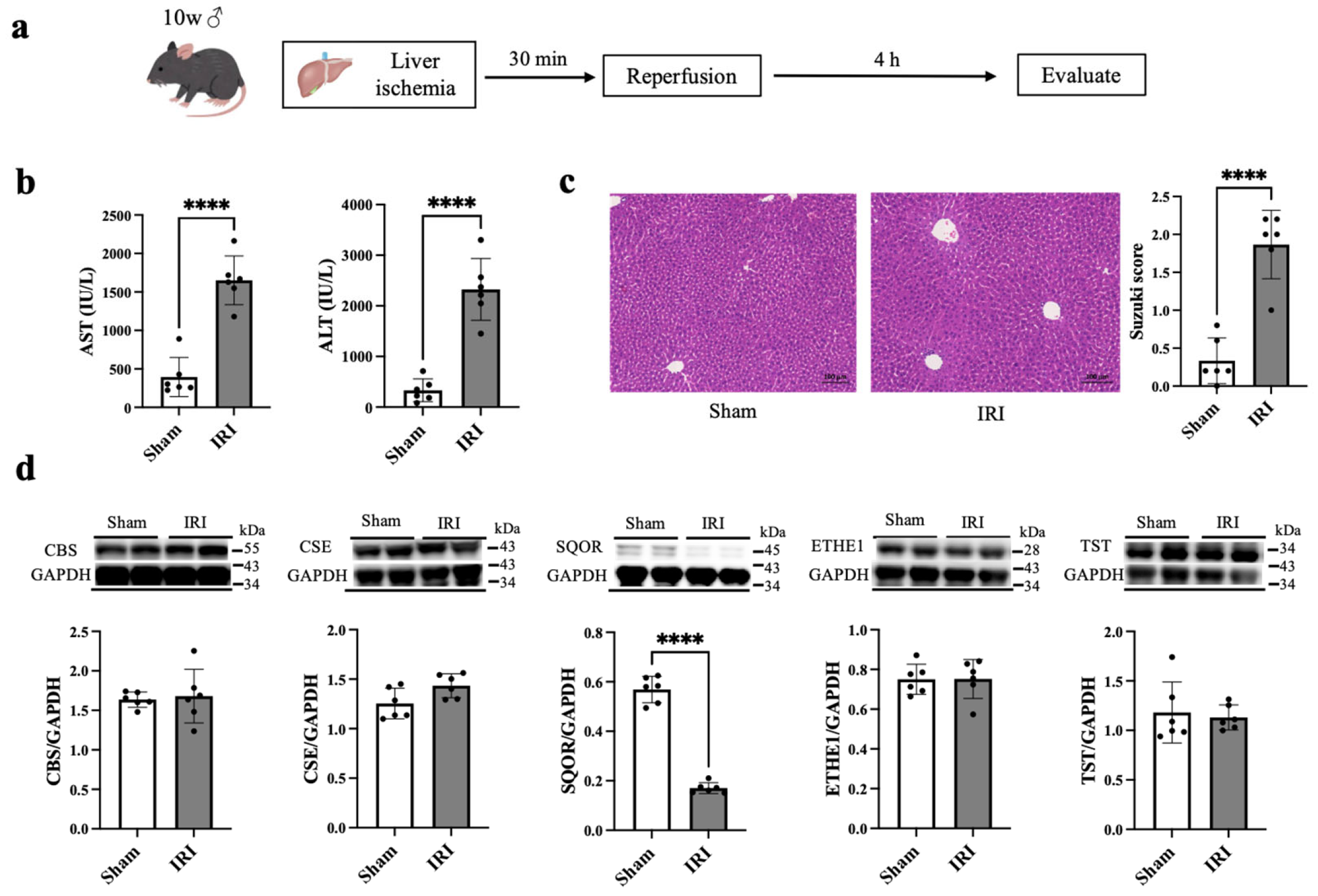 Role of Sulfide Quinone Oxidoreductase and Supersulfides in Hepatic ...
