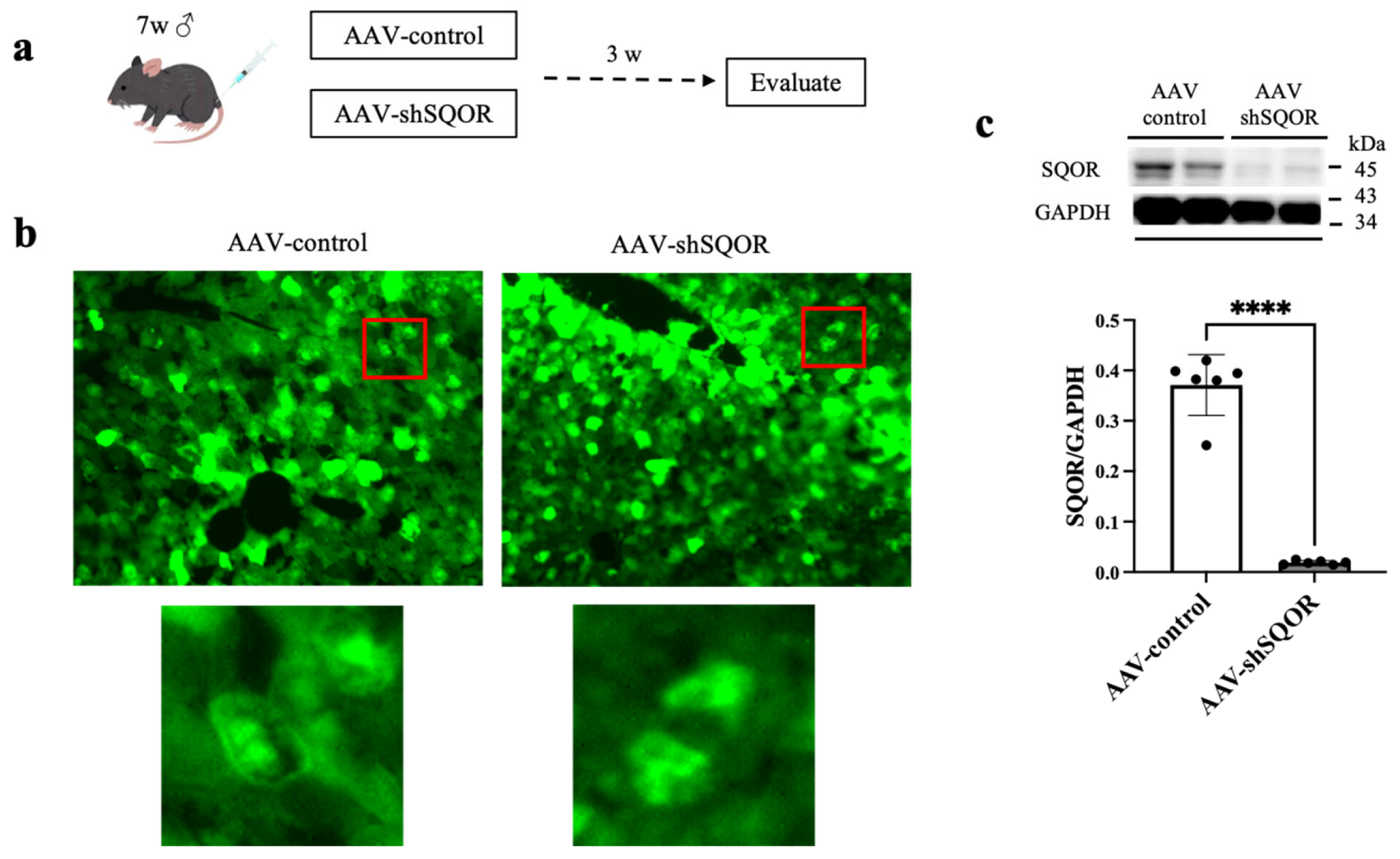 Role of Sulfide Quinone Oxidoreductase and Supersulfides in Hepatic ...