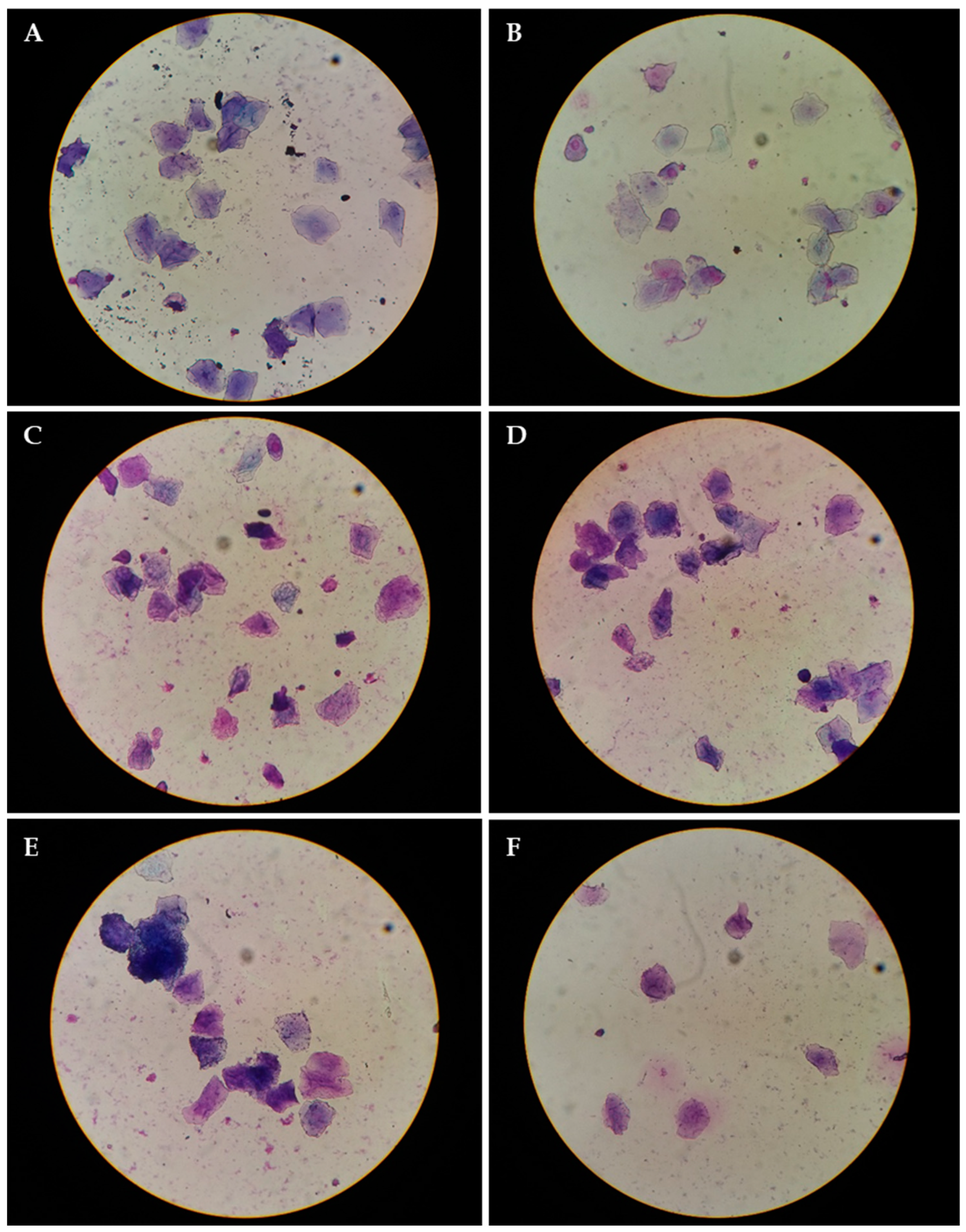 Scanning electron microscopy of the L. rhamnosus CRL 1332 biofilm