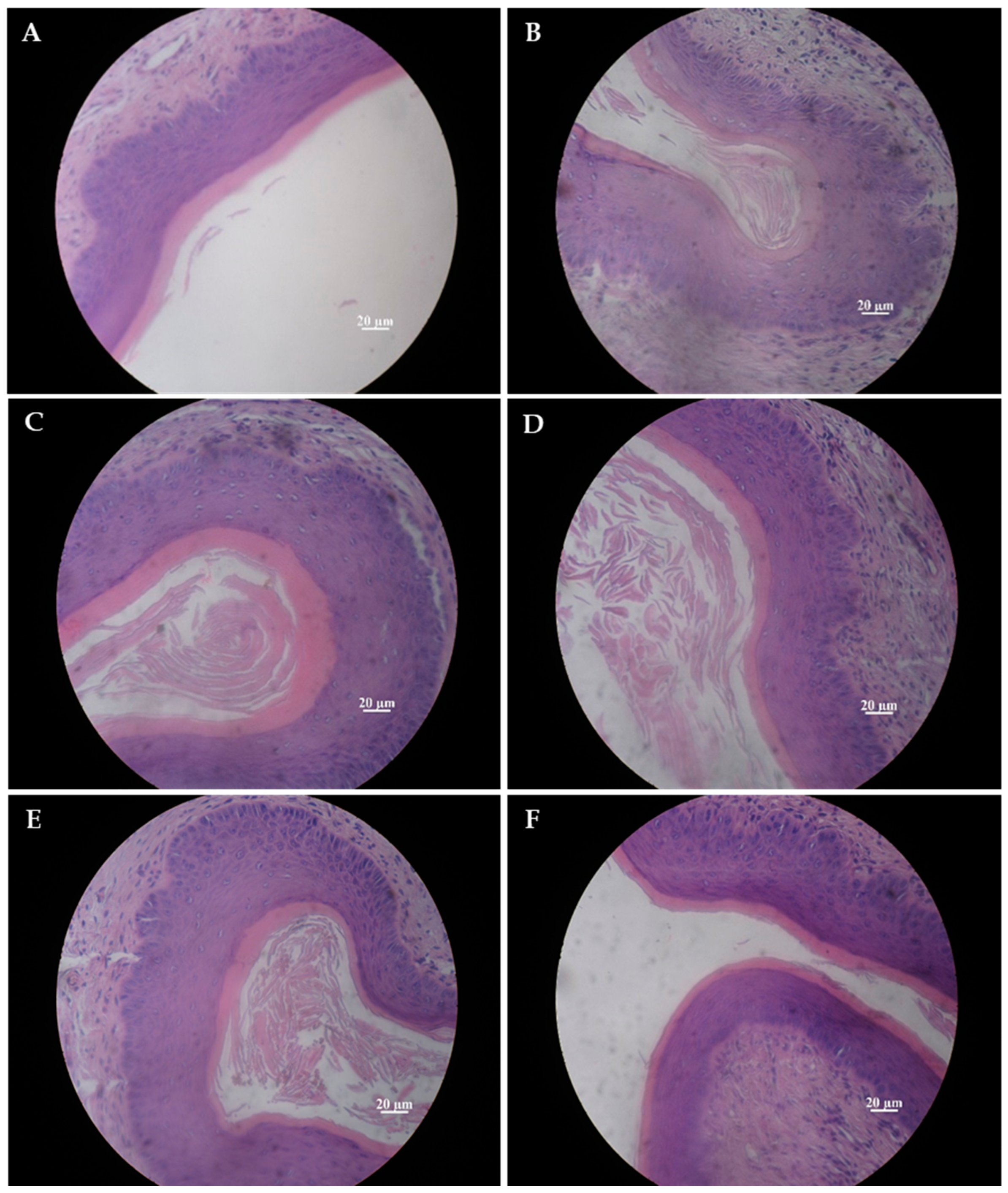 Applied Microbiology | Free Full-Text | Safety and Effects of Intravaginal  Administration of Lacticaseibacillus rhamnosus CRL1332 Immobilized on  Nanofibers in a Murine Experimental Model