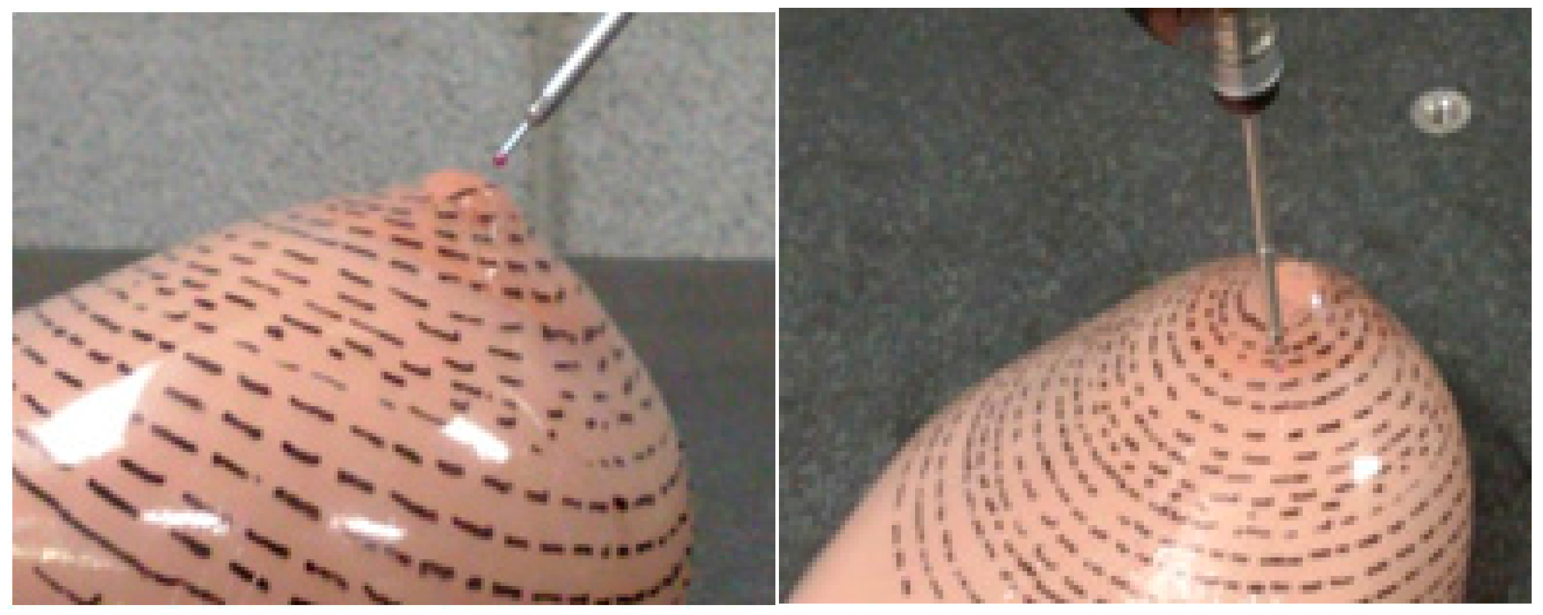 Prosthetic Breast Inserts, Prosthesis Breast Symmetrical