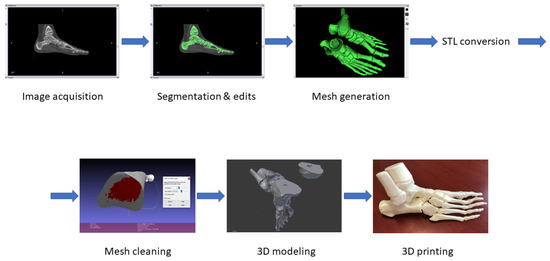 CT Conversion Workflow for Intraoperative Usage of Bony Models: From ...