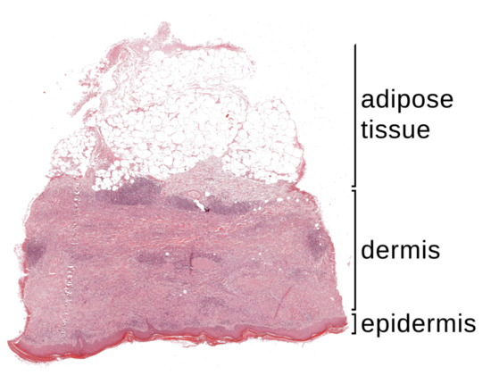 Skin Inconsistence Applied Sciences | Free Full-Text | A New Approach to Border ...