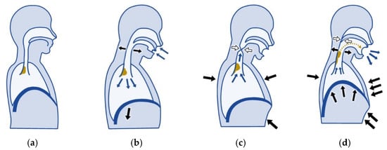 Applied Sciences | Free Full-Text | Clinical Significance of Cough Peak ...