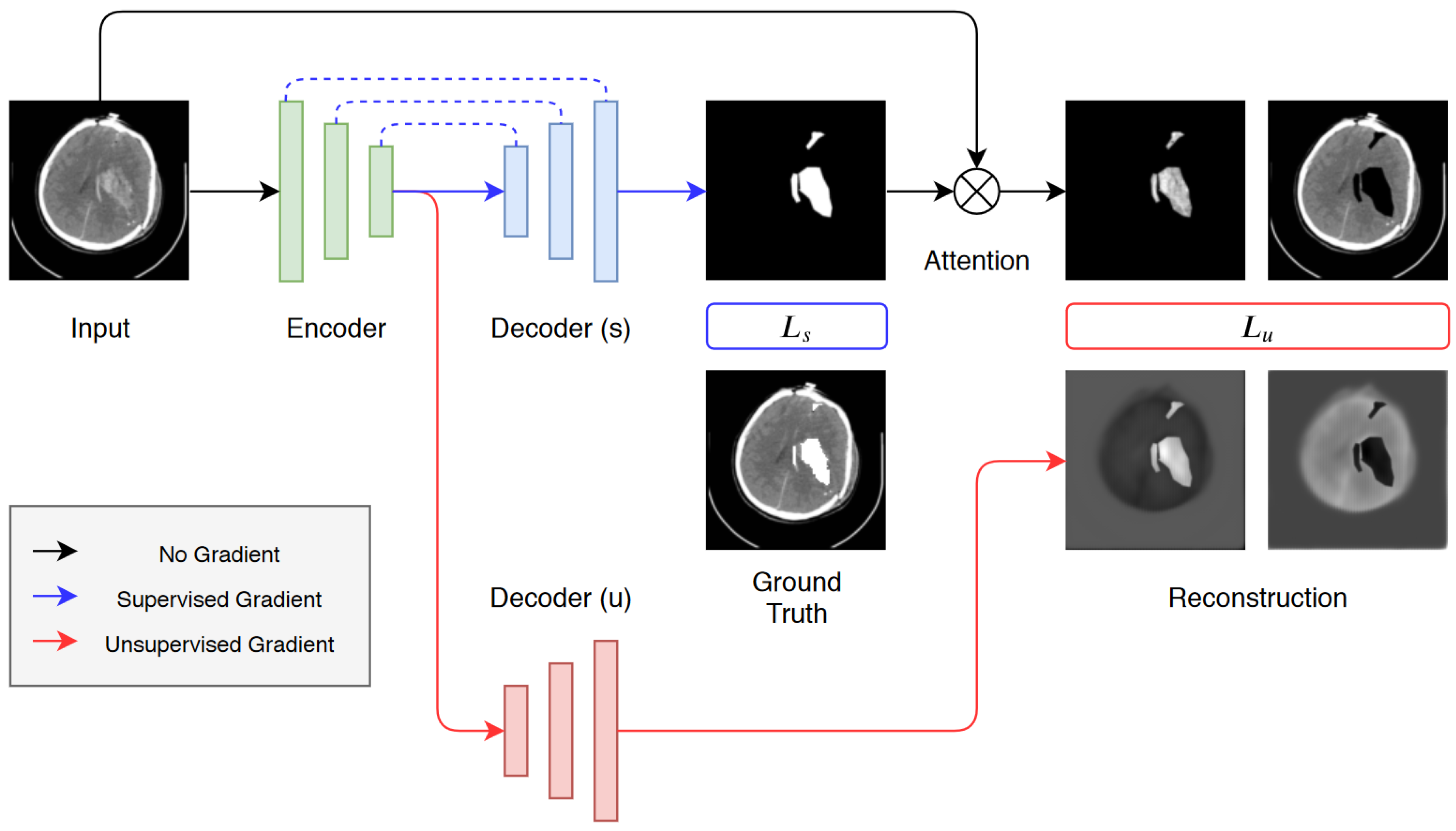 Applied Sciences Free Full Text Segmentation Of Intracranial