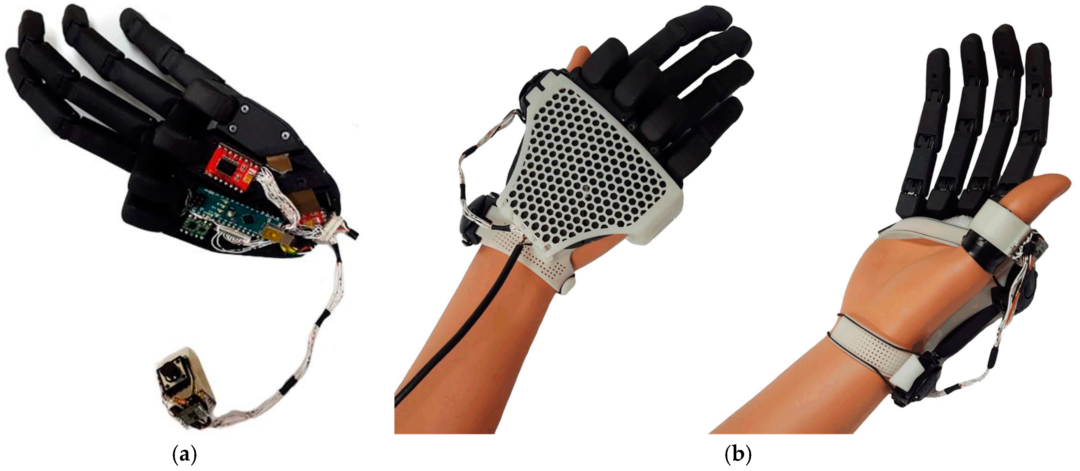 Above-the-elbow amputee 'moves individual fingers in bionic limb in world  first