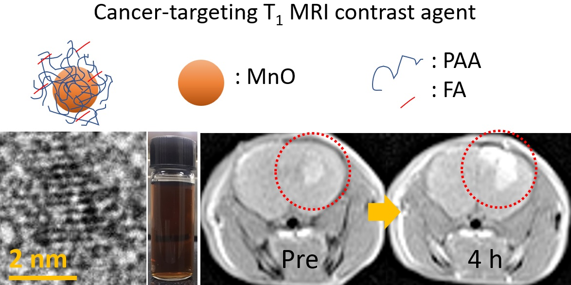 MRI contrast agents: Classification and application (Review)