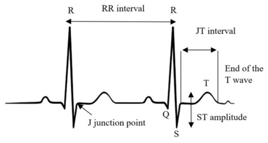 Applied Sciences | Free Full-Text | Detection of Ischemic Episodes ...