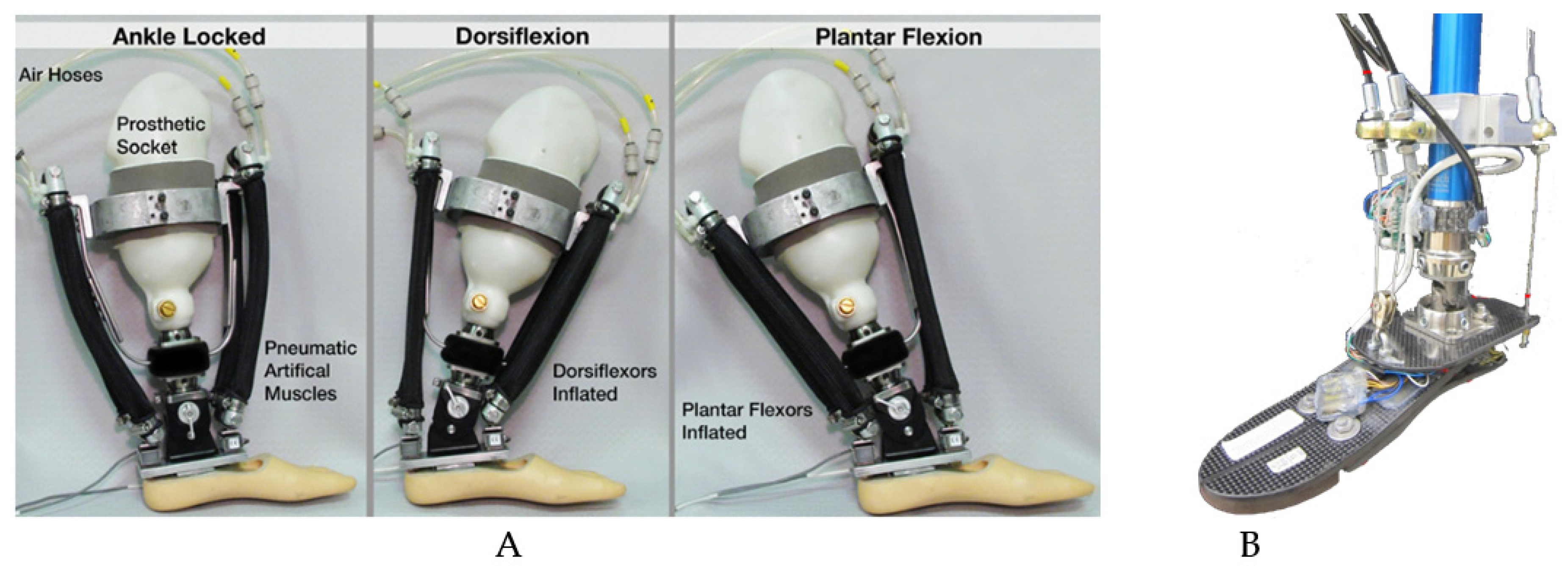 Improved Self-Reported Comfort, Stability, and Limb Temperature Regulation  With an Immediate Fit, Adjustable Transtibial Prosthesis - ScienceDirect