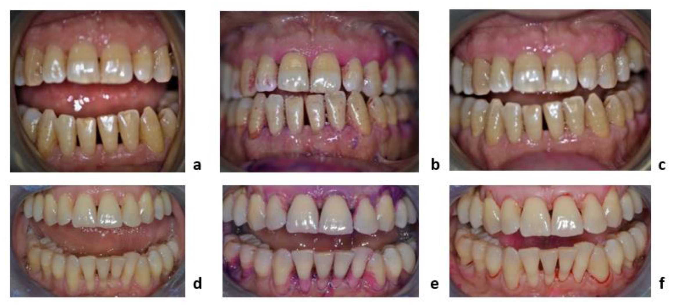 https://pub.mdpi-res.com/applsci/applsci-11-07180/article_deploy/html/images/applsci-11-07180-g005.png?1628228955