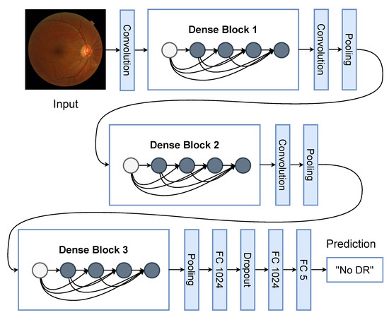 Applied Sciences | Free Full-Text | Diabetic Retinopathy Improved ...