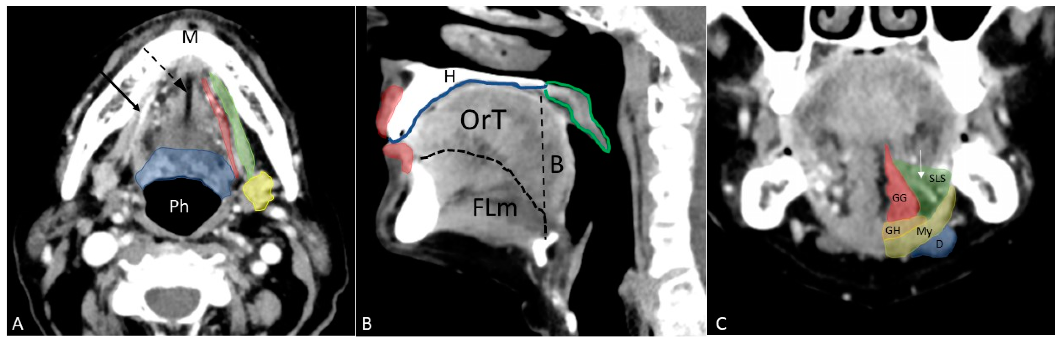 Contrast‐enhanced micro‐computed tomography of compartment and