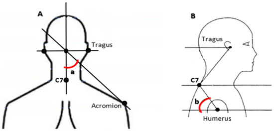 Applied Sciences | Free Full-Text | Effect of Rounded and Hunched ...