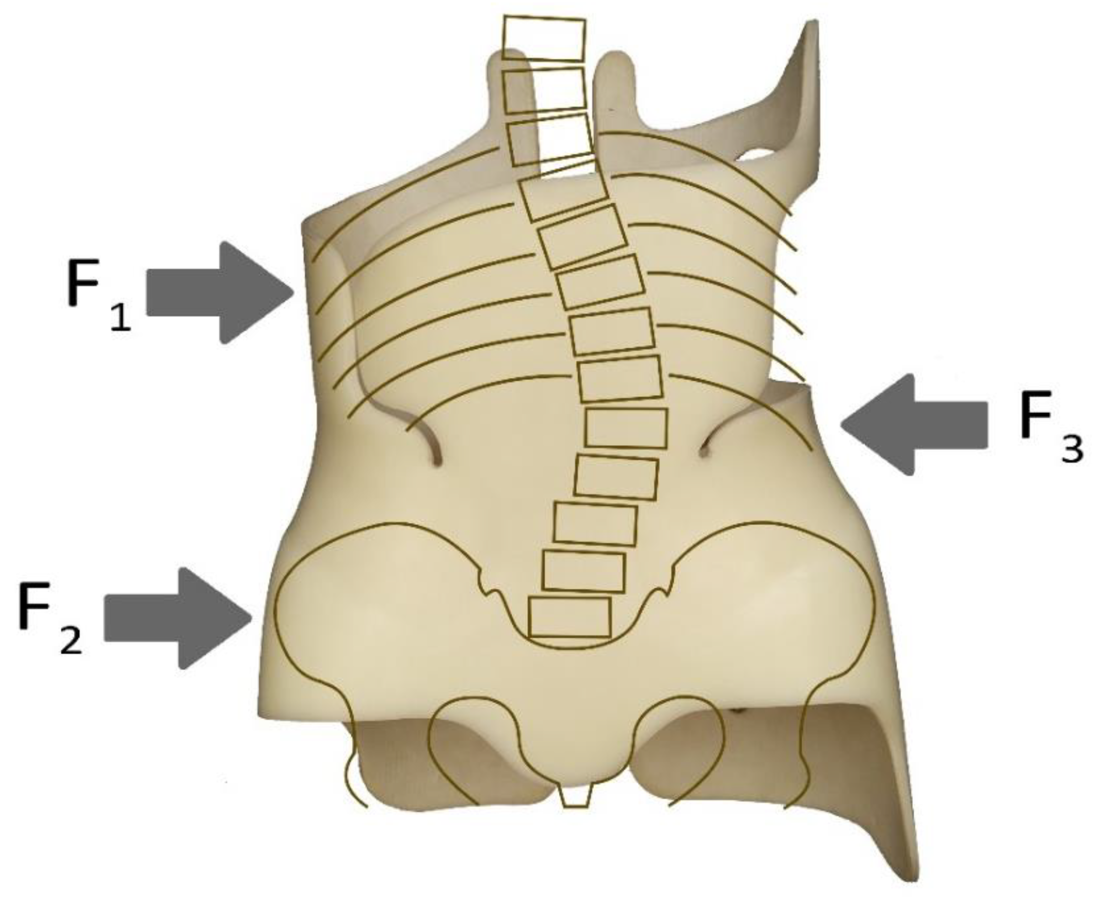 Cloth gusset on a Boston brace: a antero-lateral view, b posterior view