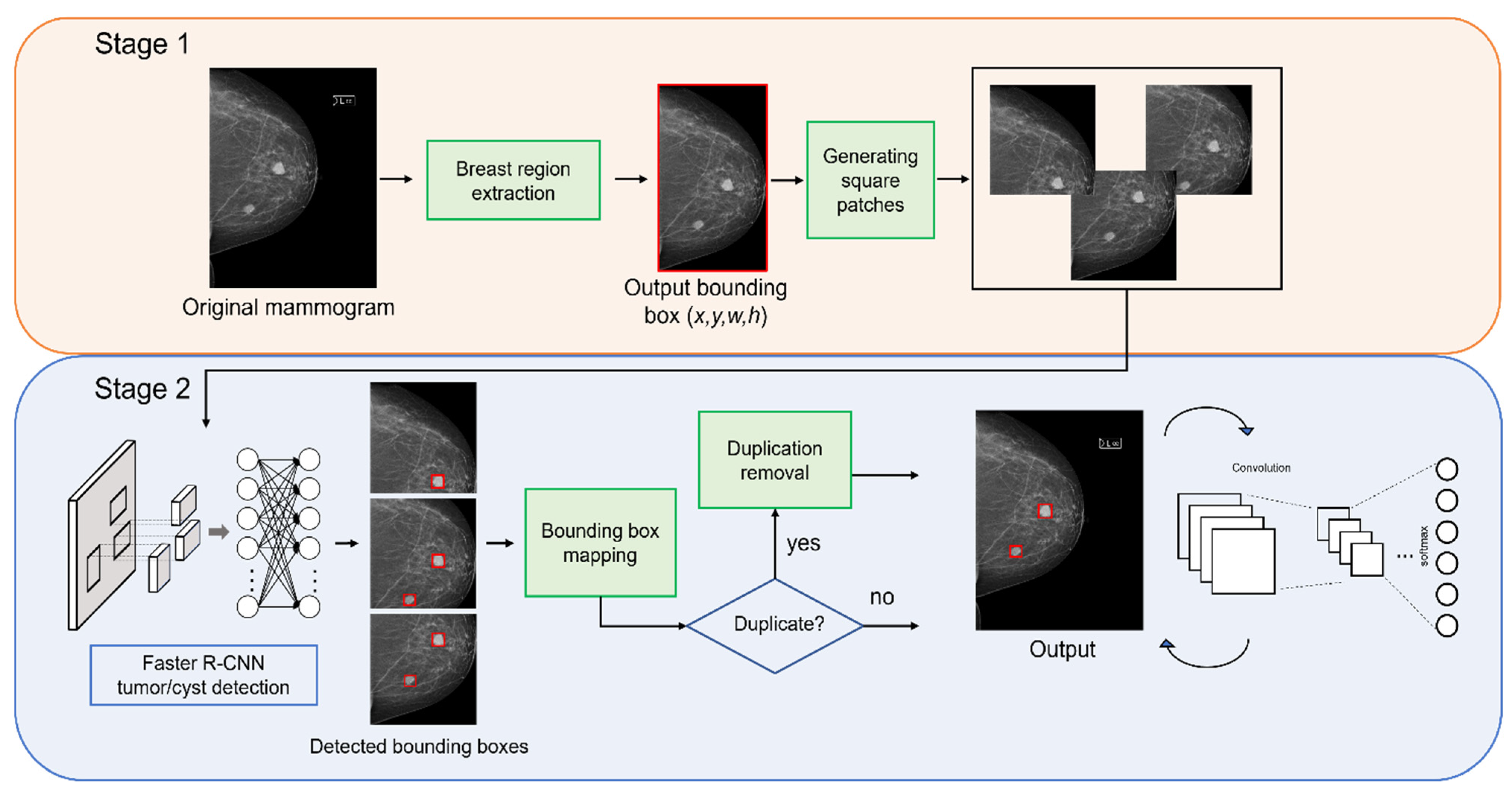 breast cancer detection using deep learning research paper