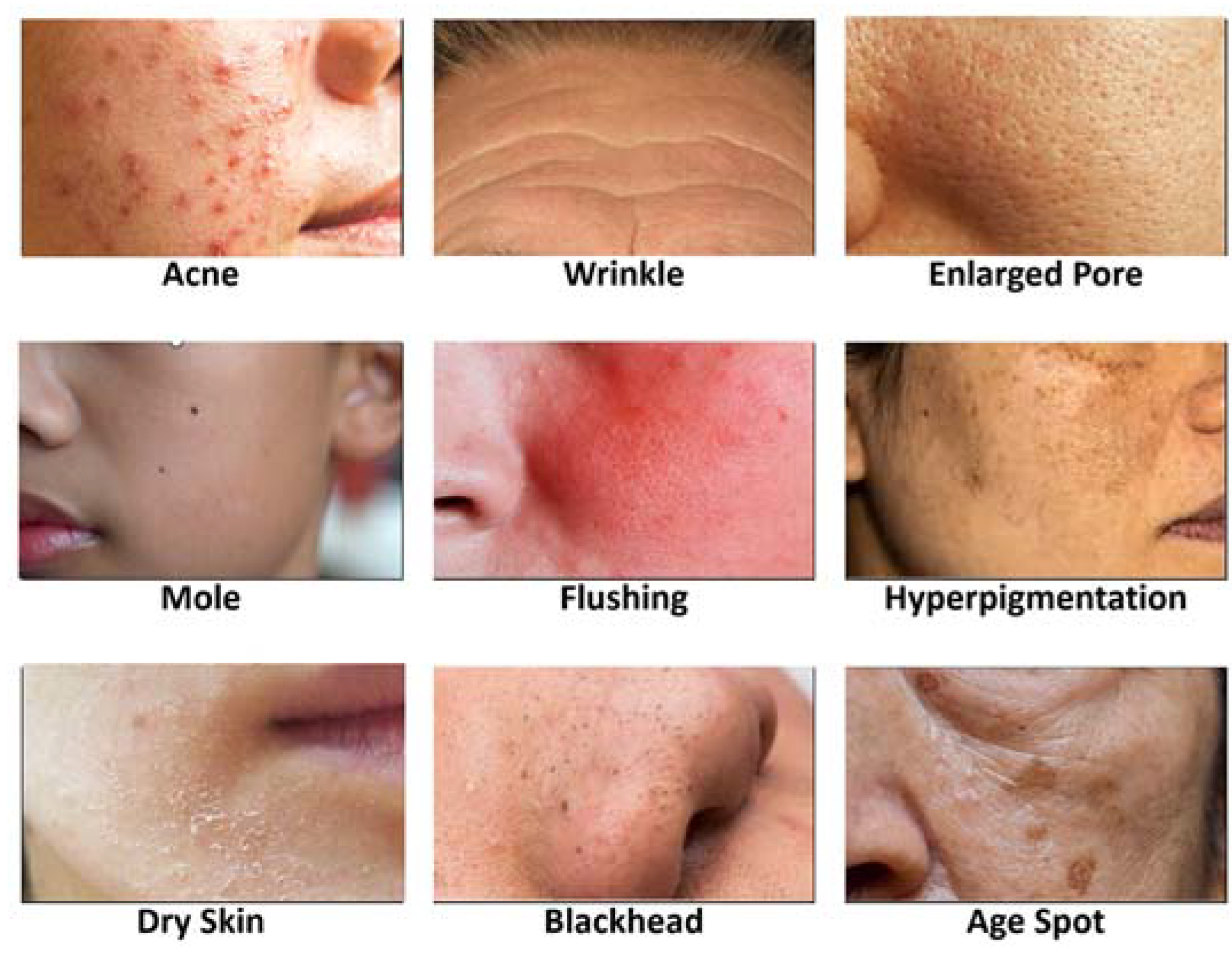 research on skin problems