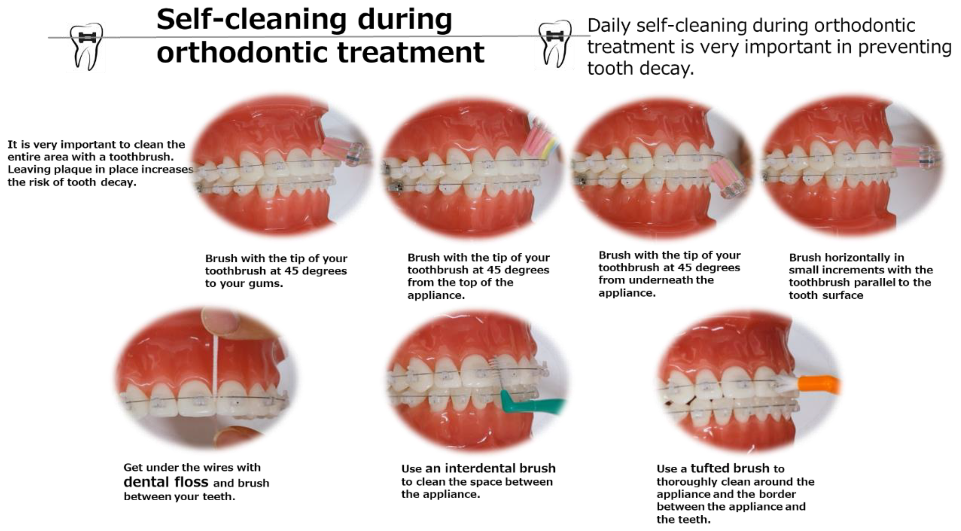 The Relationship Between Straight Teeth and Good Hygiene - Ascent