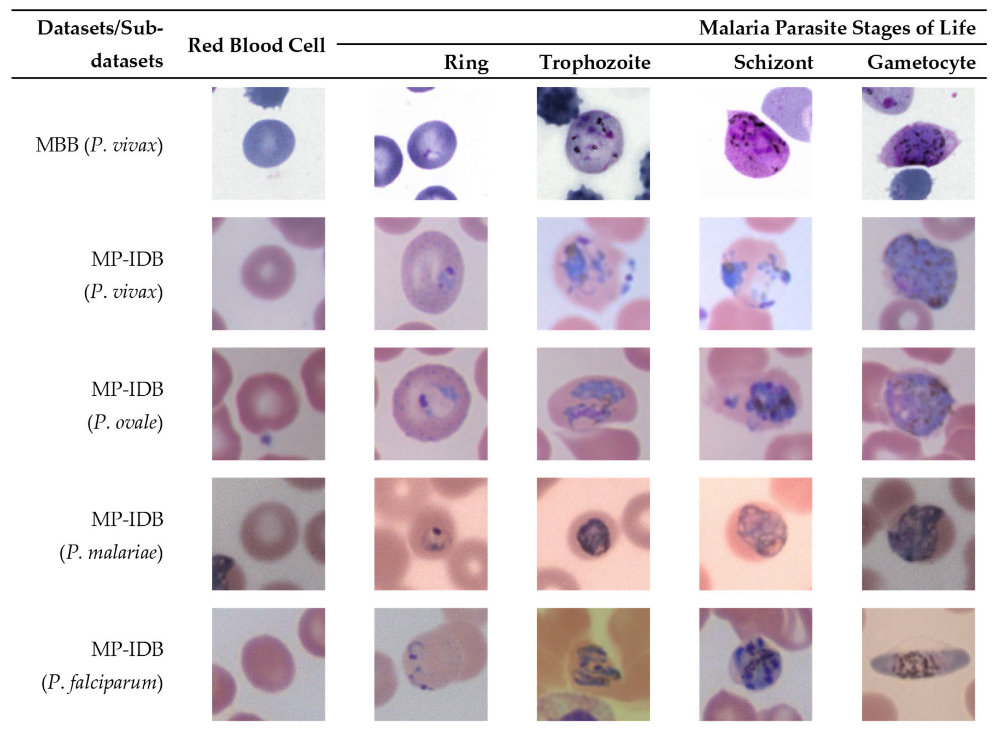 Staining Independent Malaria Parasite Detection And Life Stage Staining Independent Malaria Parasite Detection And Life Stage