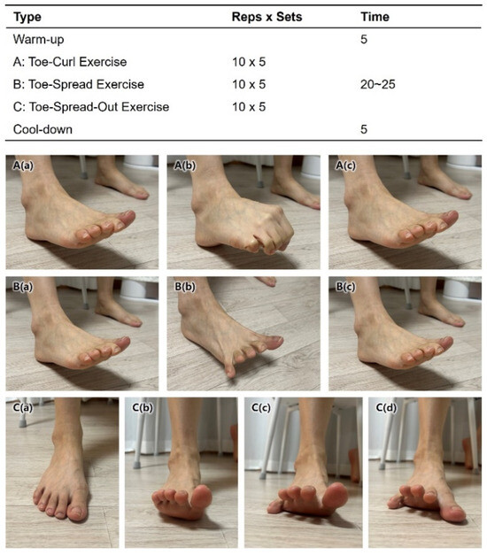 Effects Of Toe Strengthening Exercises On Medial Longitudinal Arch Effects Of Toe Strengthening Exercises On Medial Longitudinal Arch