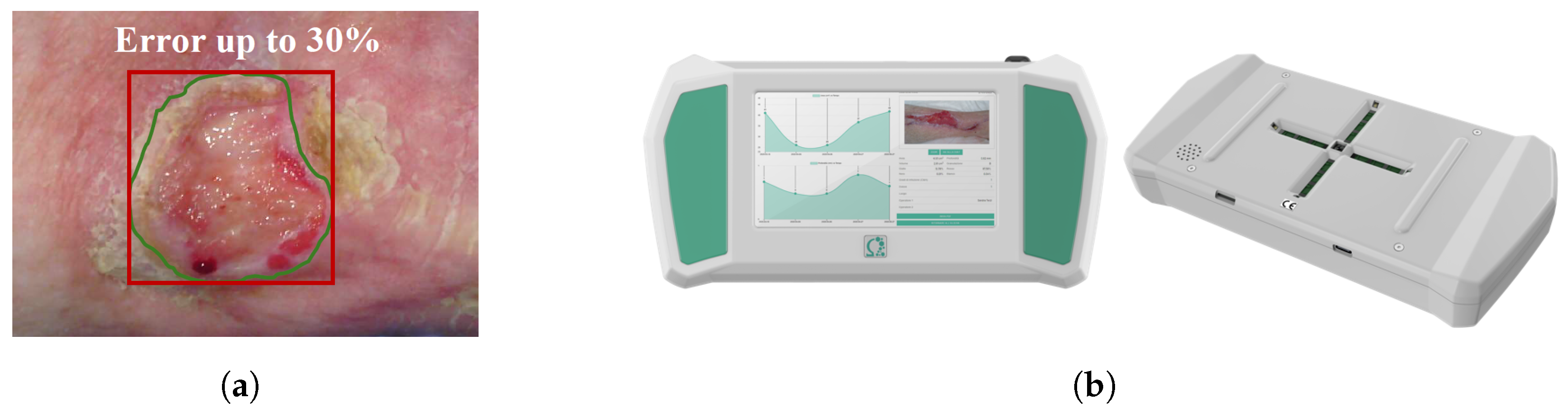 Enhancing Clinical Assessment of Skin Ulcers with Automated and 