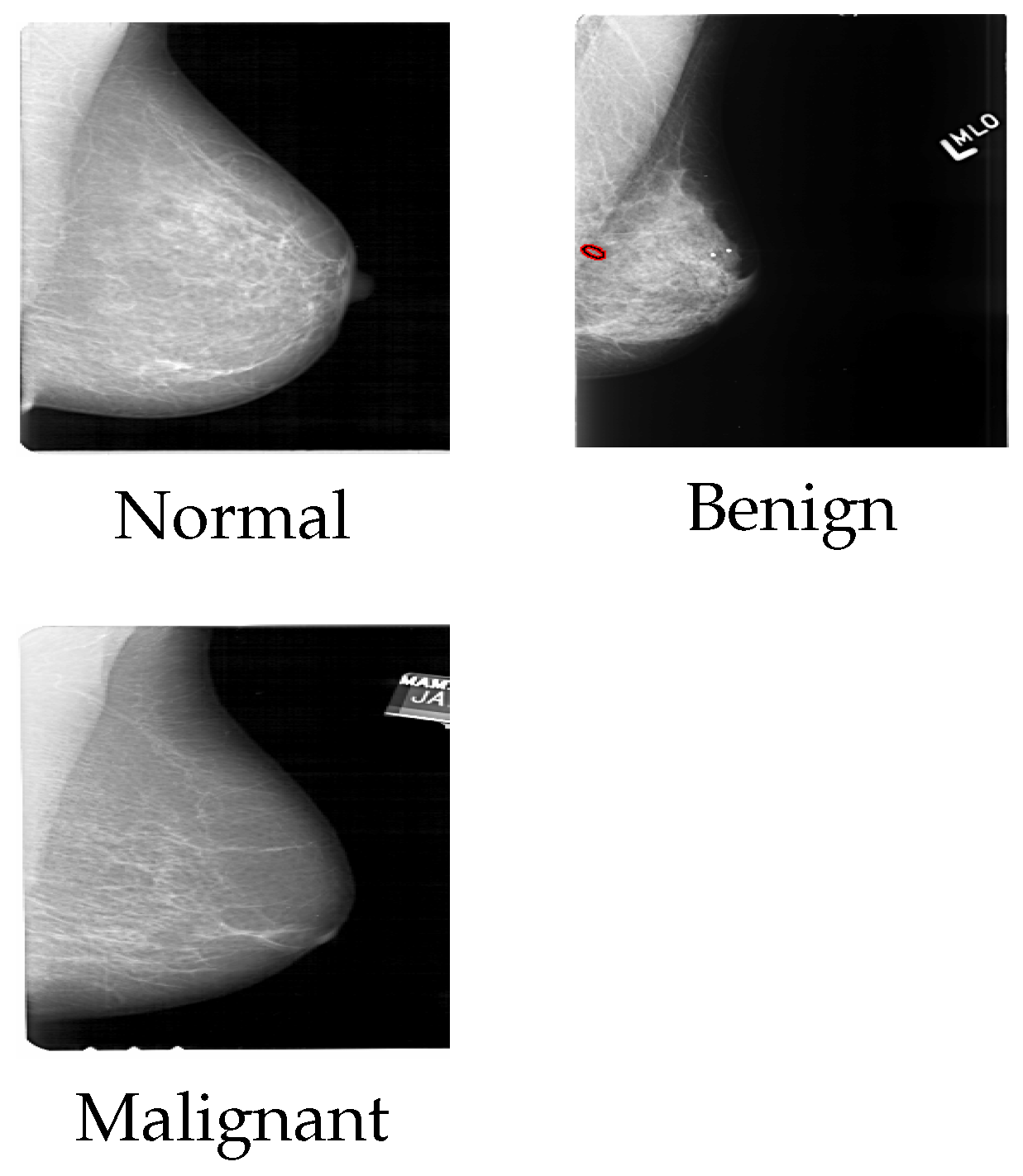 DCS-ST for Classification of Breast Cancer Histopathology Images with ...