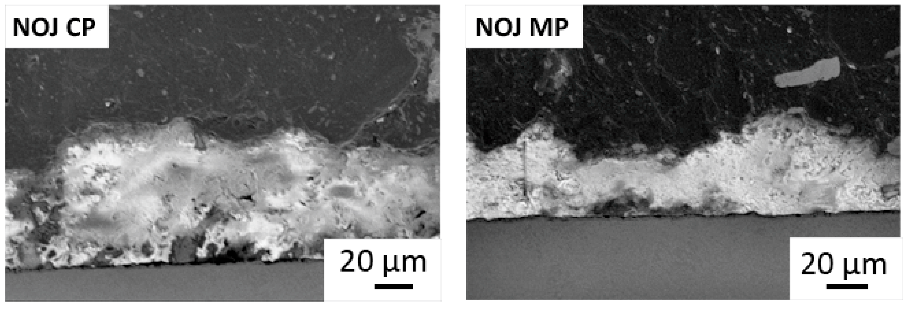 nonn！ Bone-like Carbonated Apatite Titanium Anodization Coatings