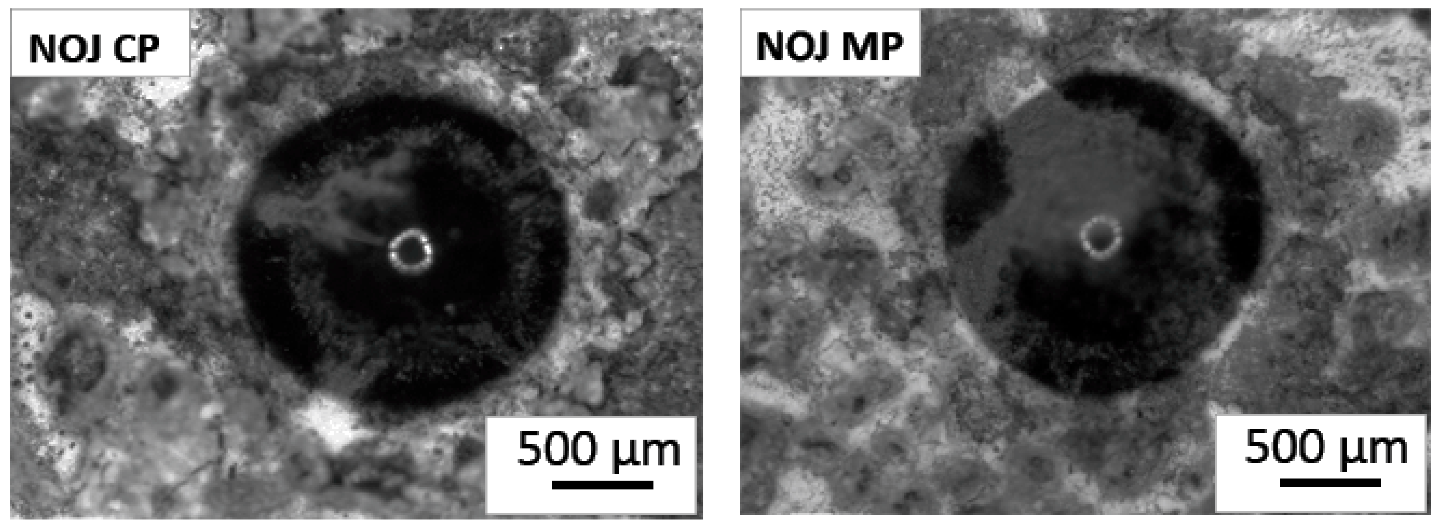 nonn！ Bone-like Carbonated Apatite Titanium Anodization Coatings