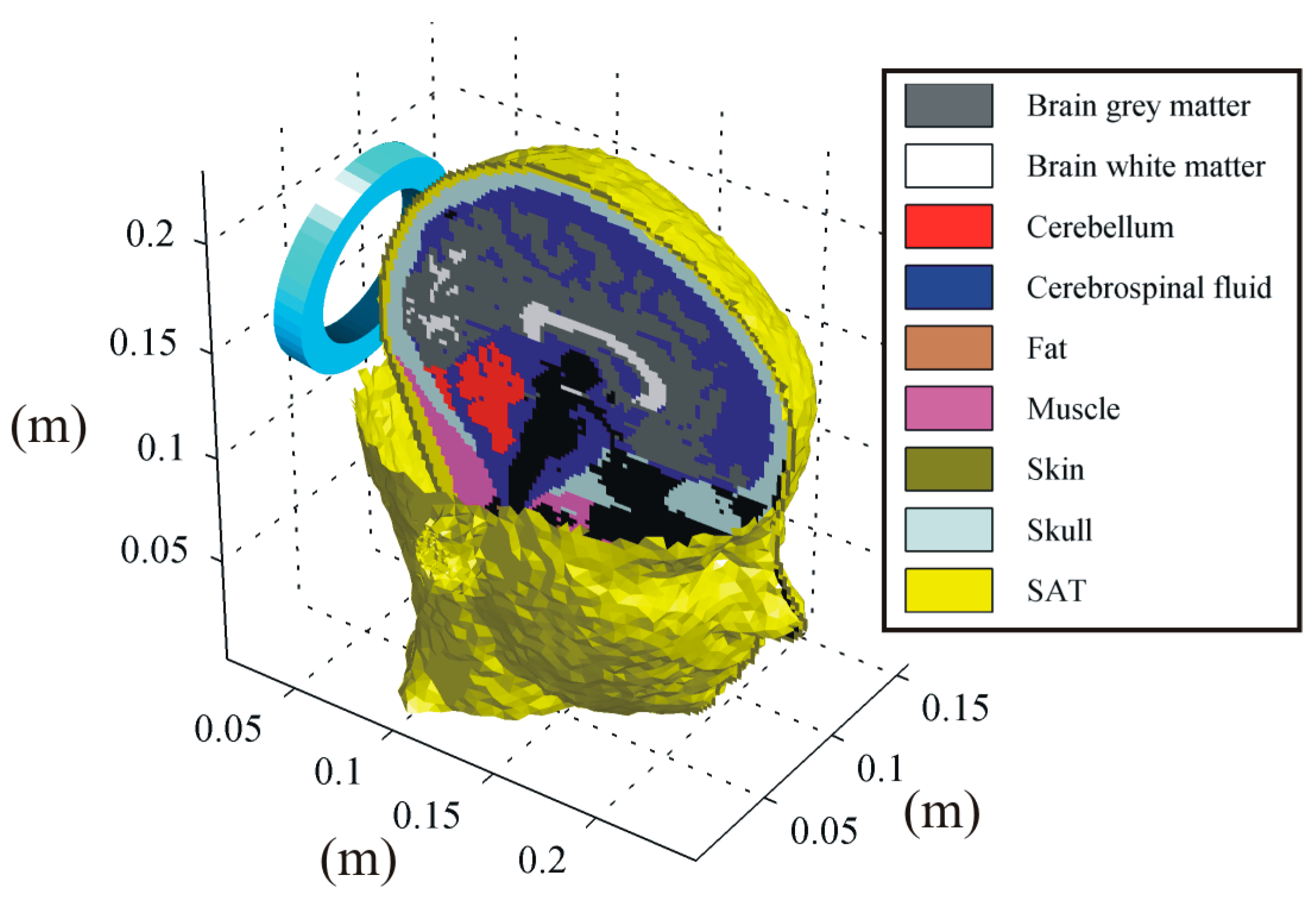 Translinear Brain Transcranial Brain Stimulation: Technical, Computational, and Clinical ...