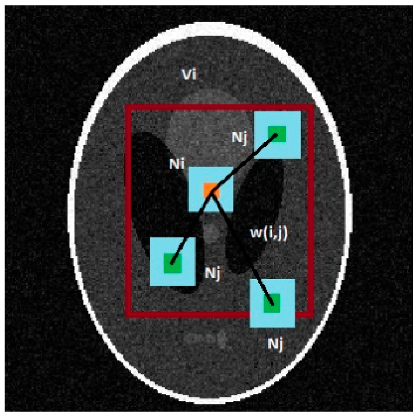 Binary Classification of Brain MR Images for Meningioma Detection