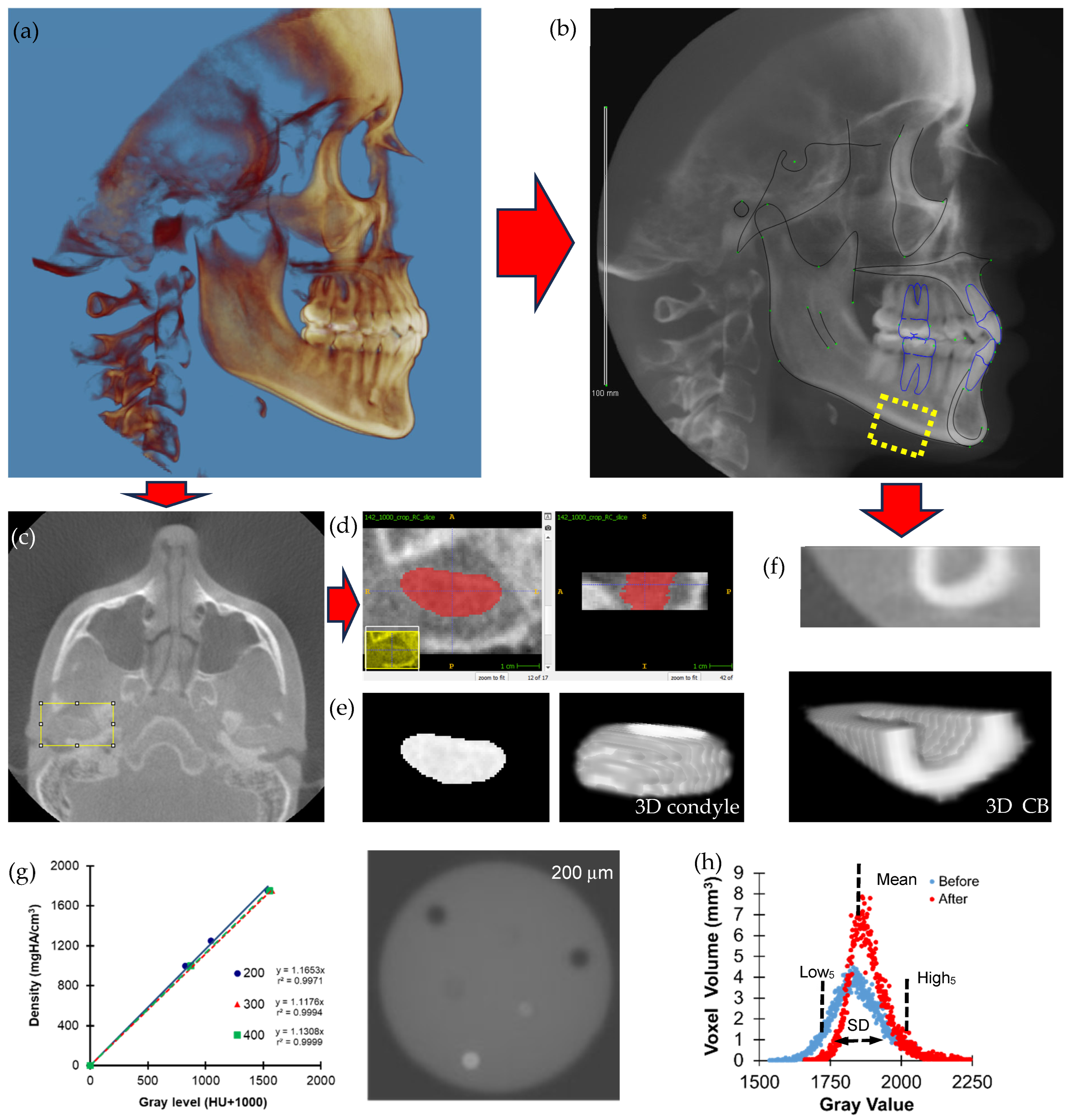 Changes in Morphology and Bone Mineral Density of Human Mandibular ...