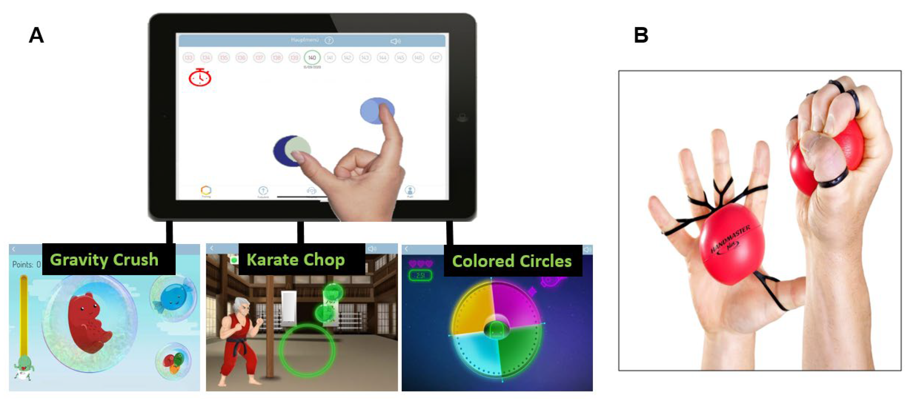 Does a Novel Gamification Approach Improve Hand Function in Patients ...