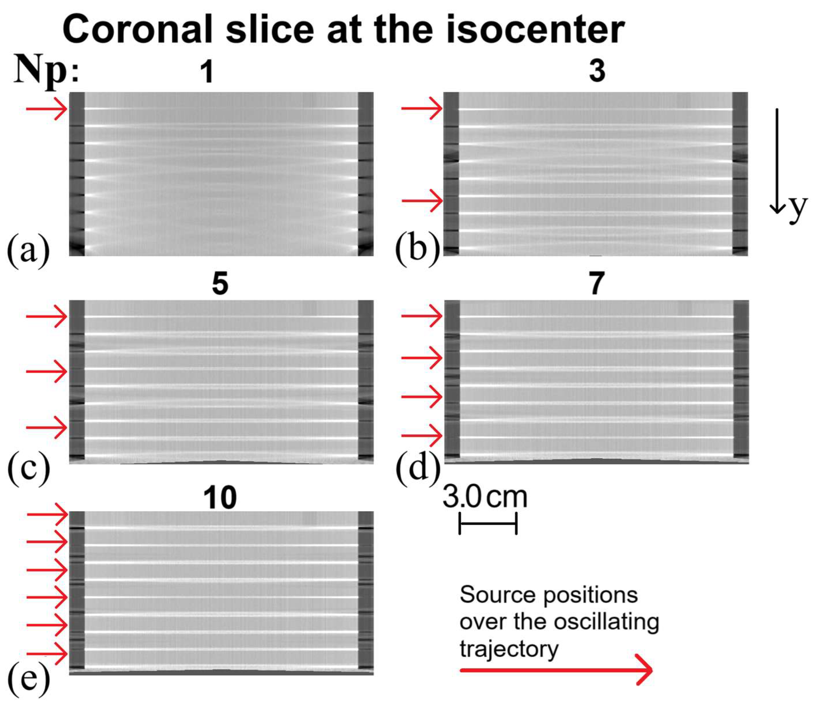 In Silico Investigation of an Innovative Cone-Beam CT Configuration for ...
