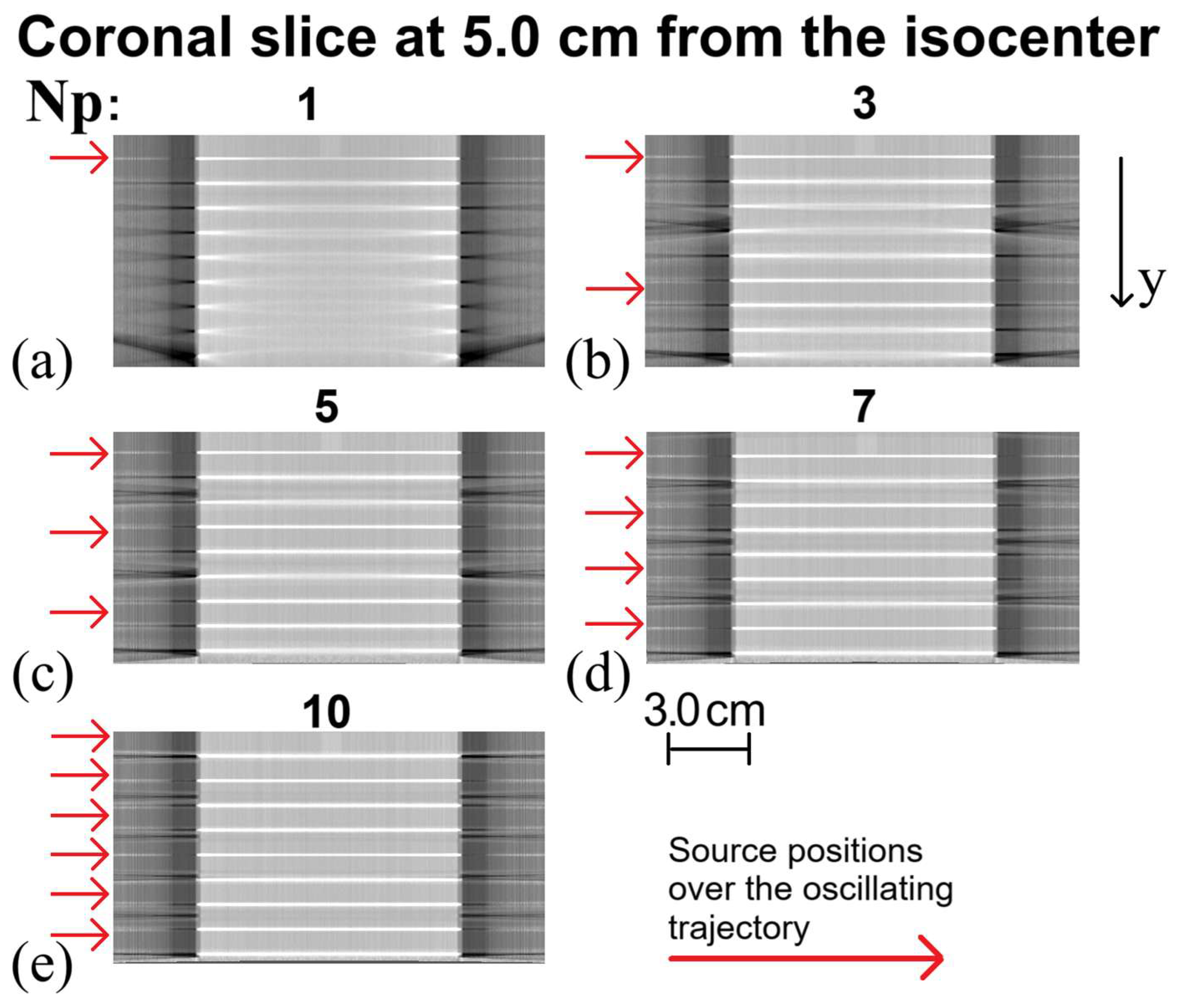 In Silico Investigation of an Innovative Cone-Beam CT Configuration for ...