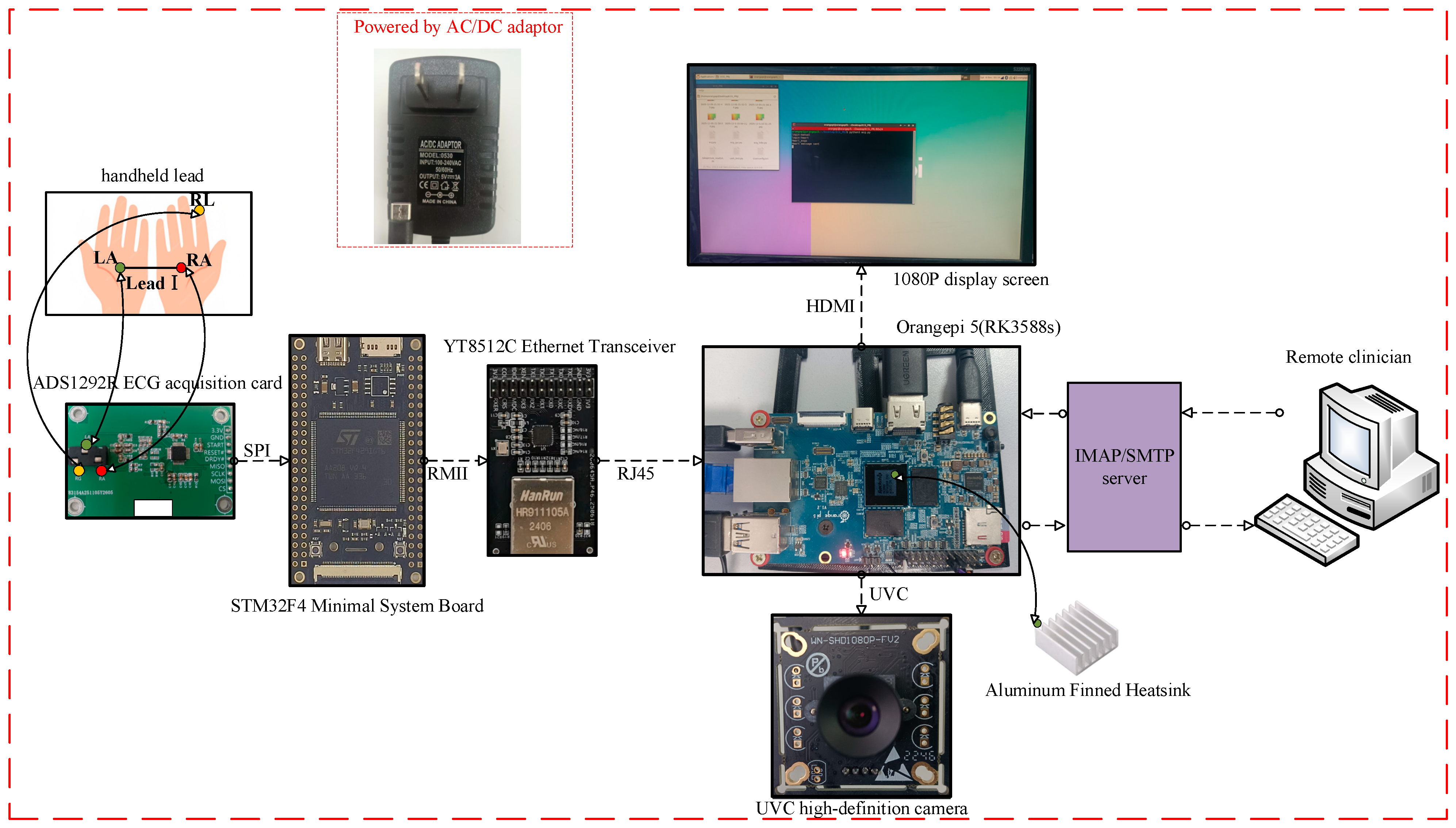 A Zero-Interaction, Cloud-Free Remote ECG Monitoring and Arrhythmia ...