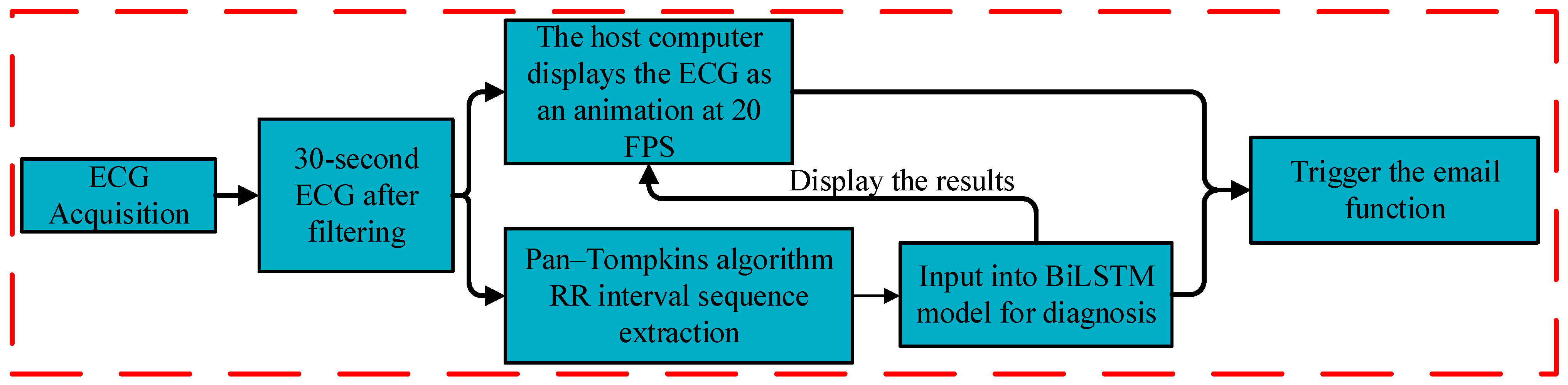 A Zero-Interaction, Cloud-Free Remote ECG Monitoring and Arrhythmia ...