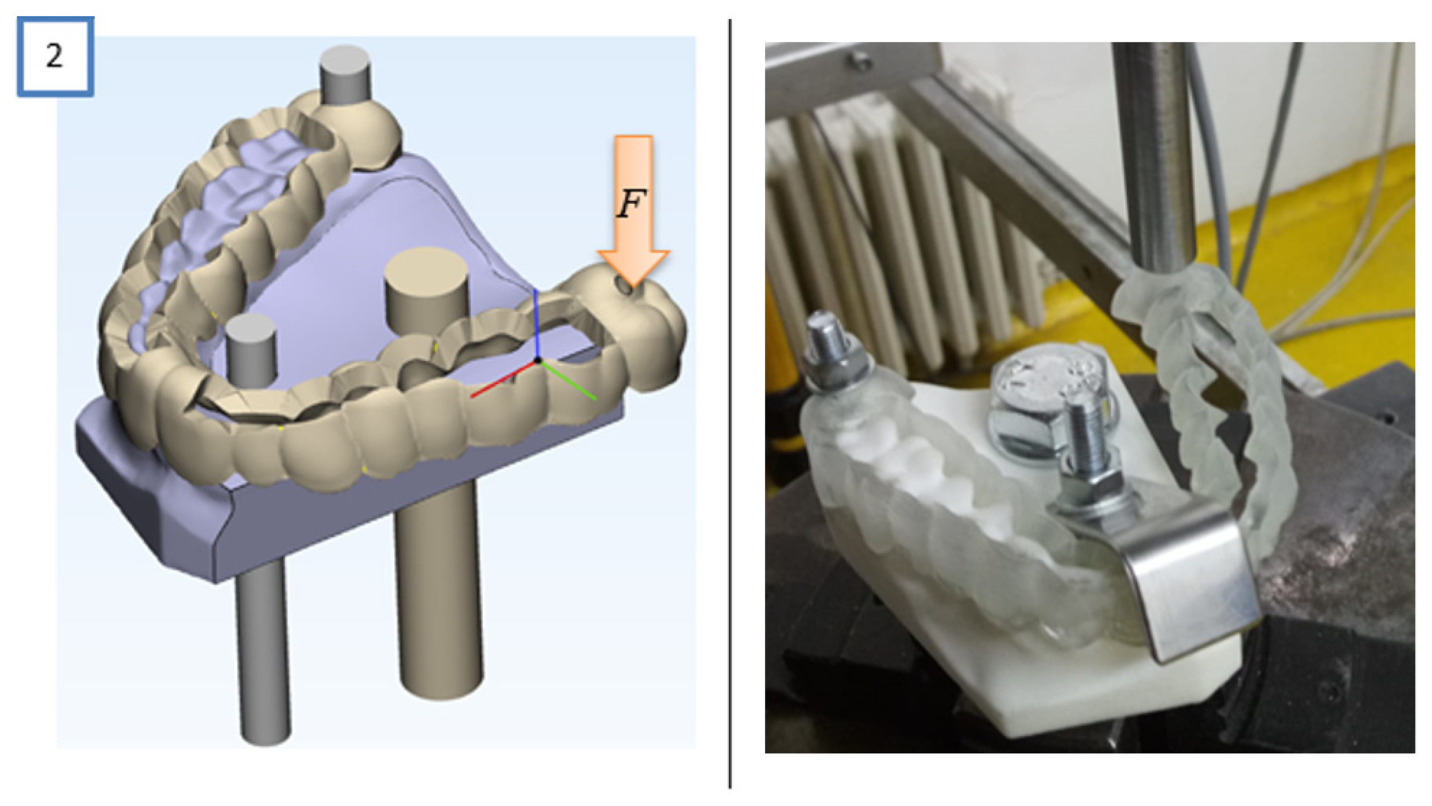 Surgical Guide Offset Advancing Guidelines for the Design of Tooth-Supported Surgical Guides ...