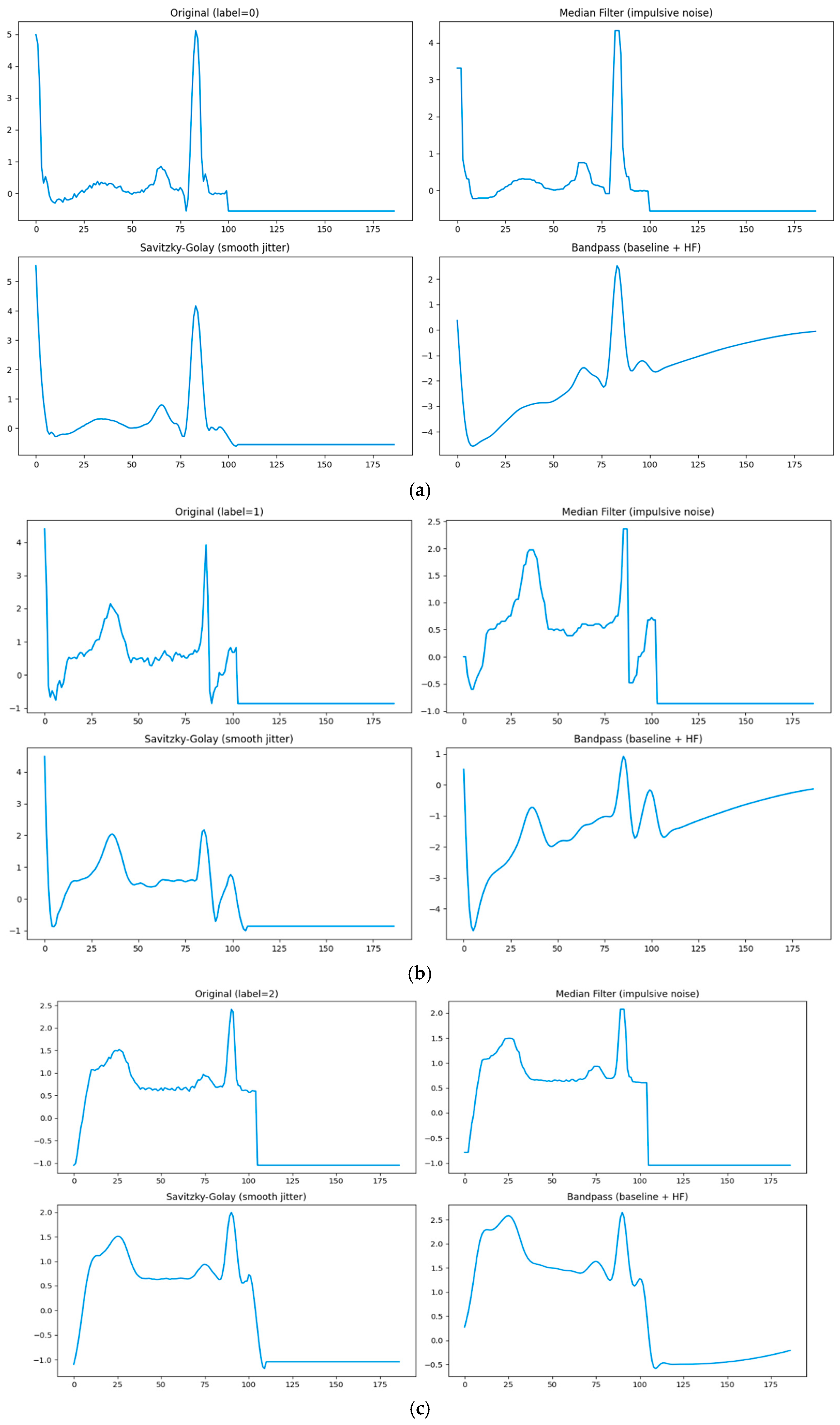 Robust and Calibrated ECG Heartbeat Classification via Hybrid ...